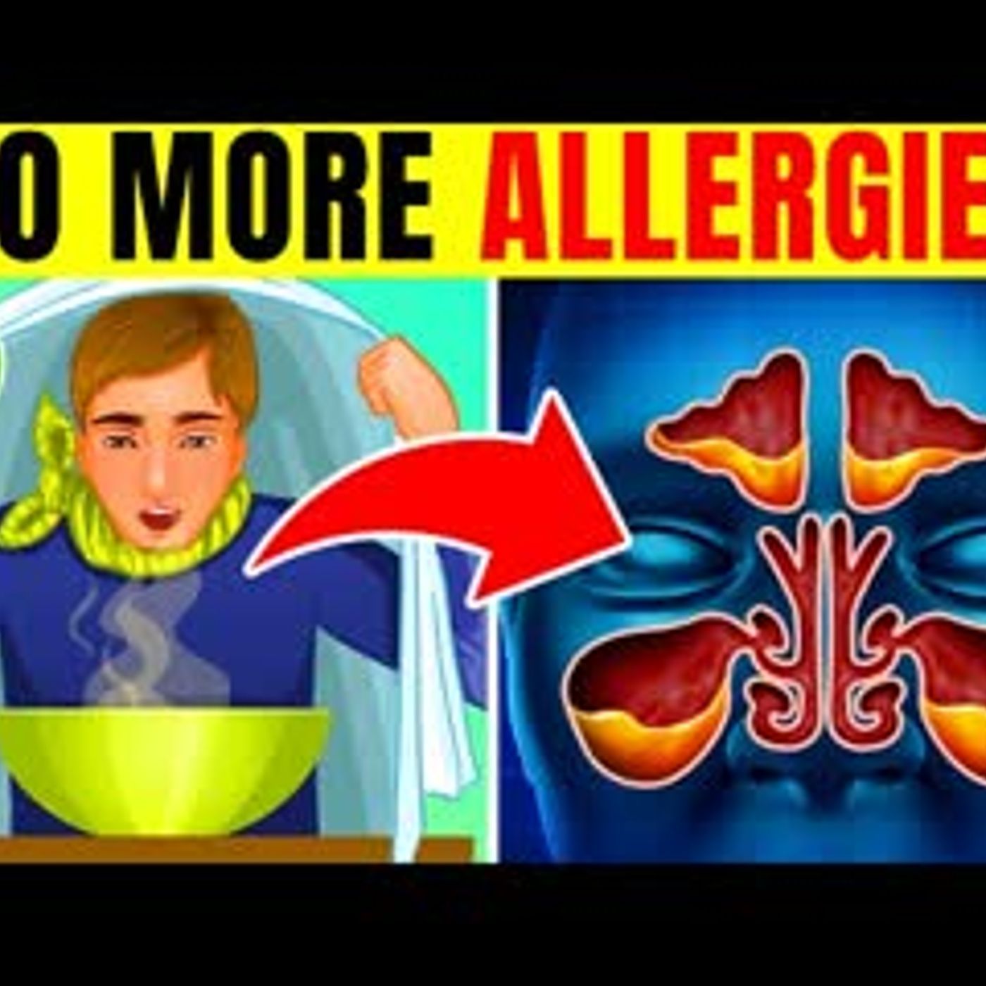 12 Ways To GET RID Of Seasonal Allergies For Good & What To Eat episode artwork