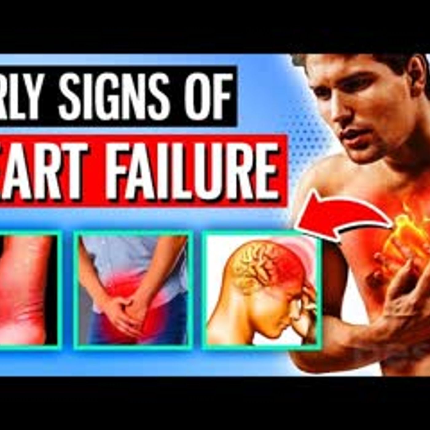 11 EARLY Signs Of Heart Failure You Should Never Ignore episode artwork
