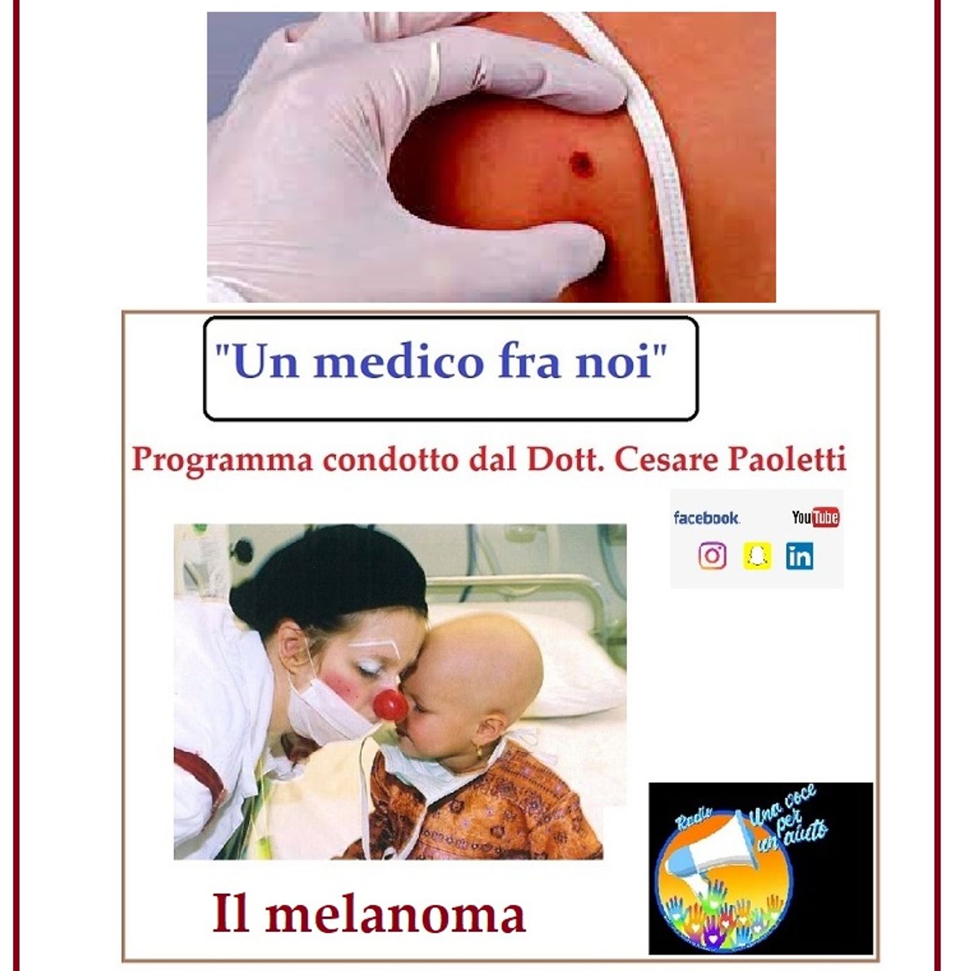 "UN MEDICO FRA NOI" Dott. Cesare Paoletti - IL MELANOMA episode artwork