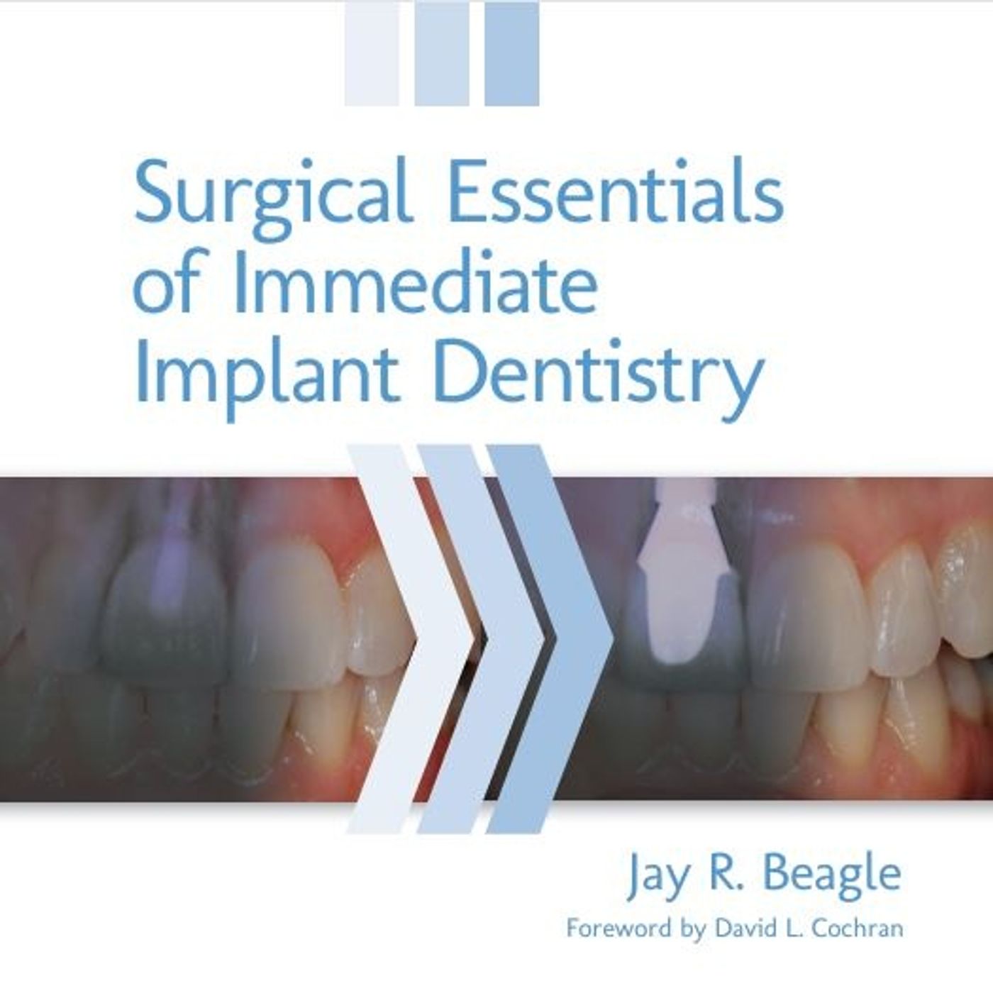 Surgical Essentials of Immediate Implant Dentistry