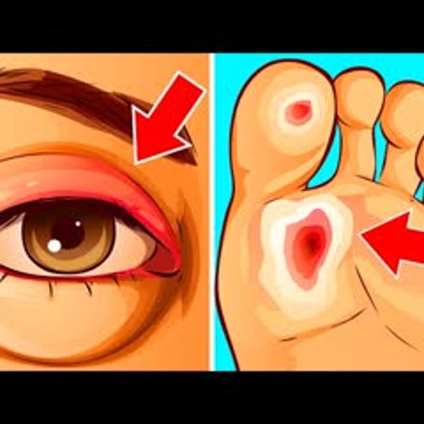 11 Signs Of Health Problems Hidden On Your Face & Body episode artwork