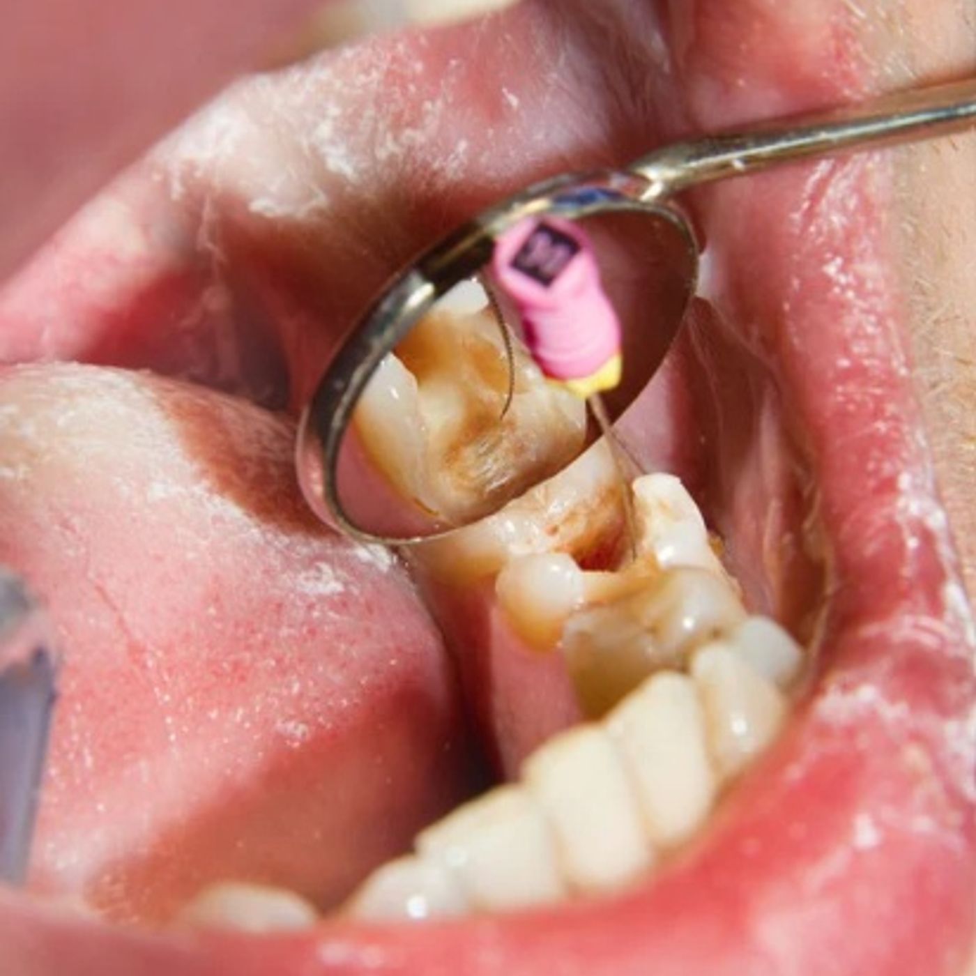 The Healthy Smile Podcast: Expert Dental