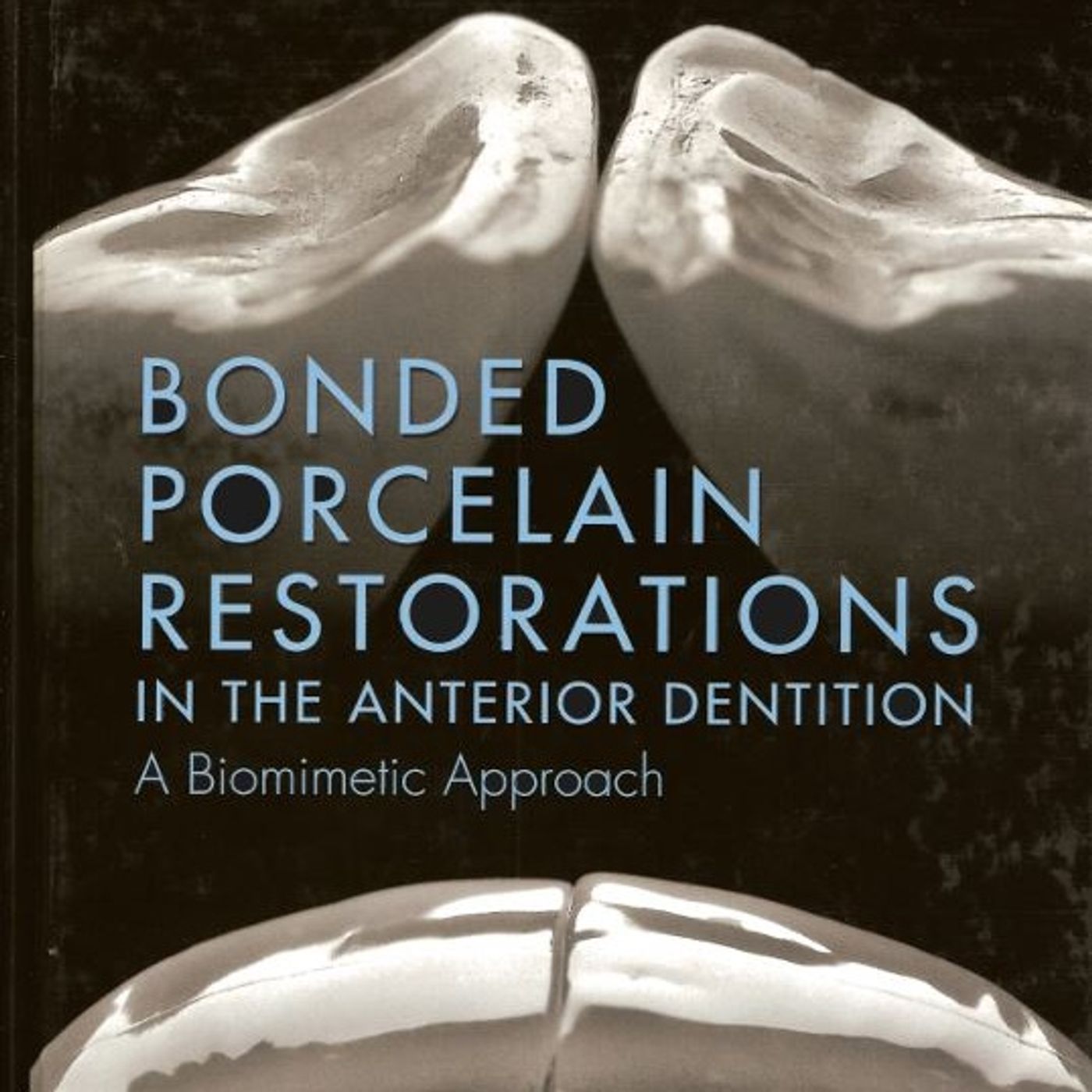 Bonded Porcelain Restorations in The Anterior Dentition: A Biomimetic Approach