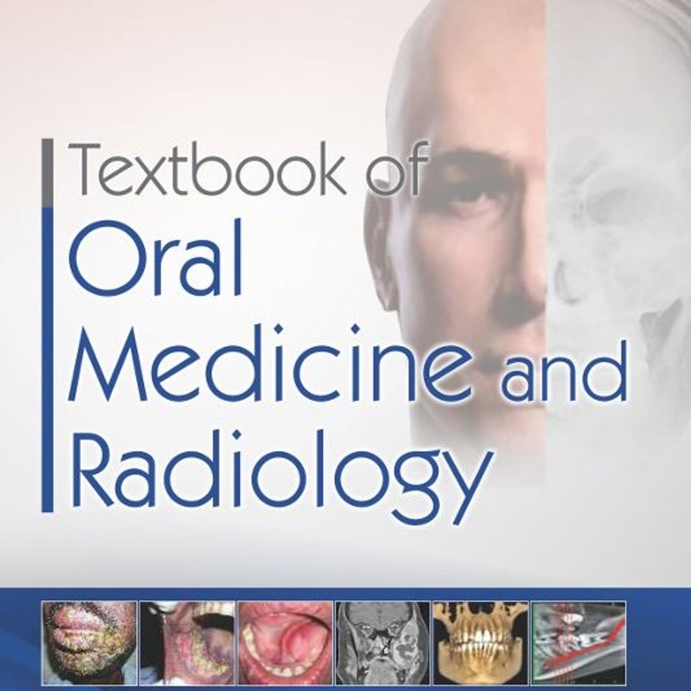 Textbook of Oral Medicine & Radiology