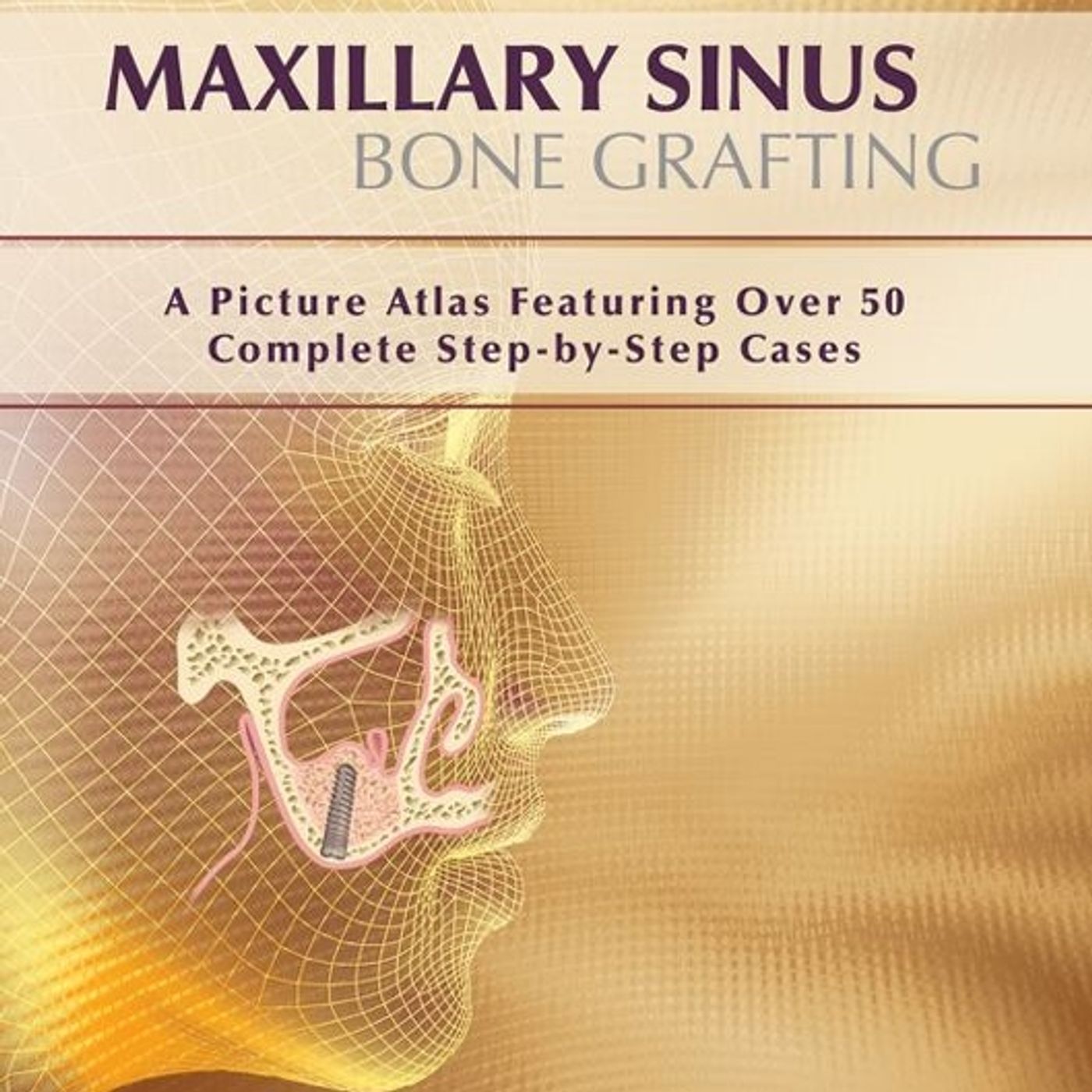 Maxillary Sinus Bone Grafting: A Picture Atlas Featuring Over 50 Complete Step-By-Step Cases episode artwork