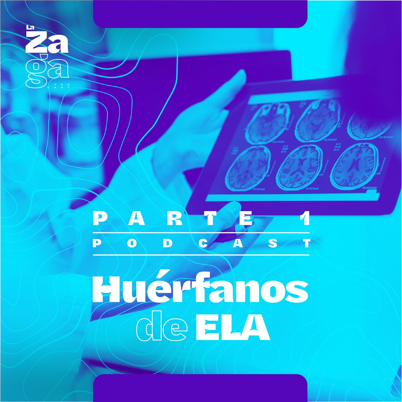 Parte 1: ELA, una enfermedad huérfana y misteriosa