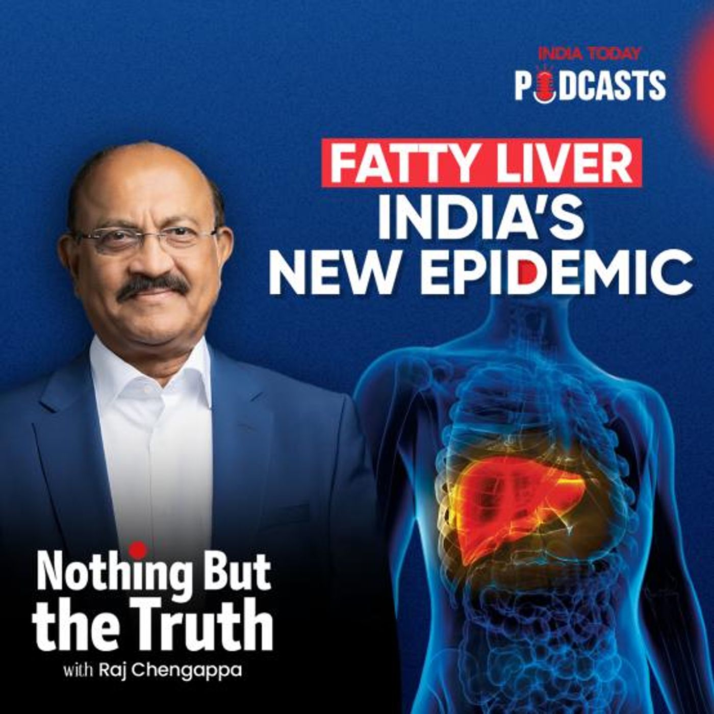 FATTY LIVER: INDIA'S NEW EPIDEMIC | Nothing But The Truth, S2, Ep 80 episode artwork