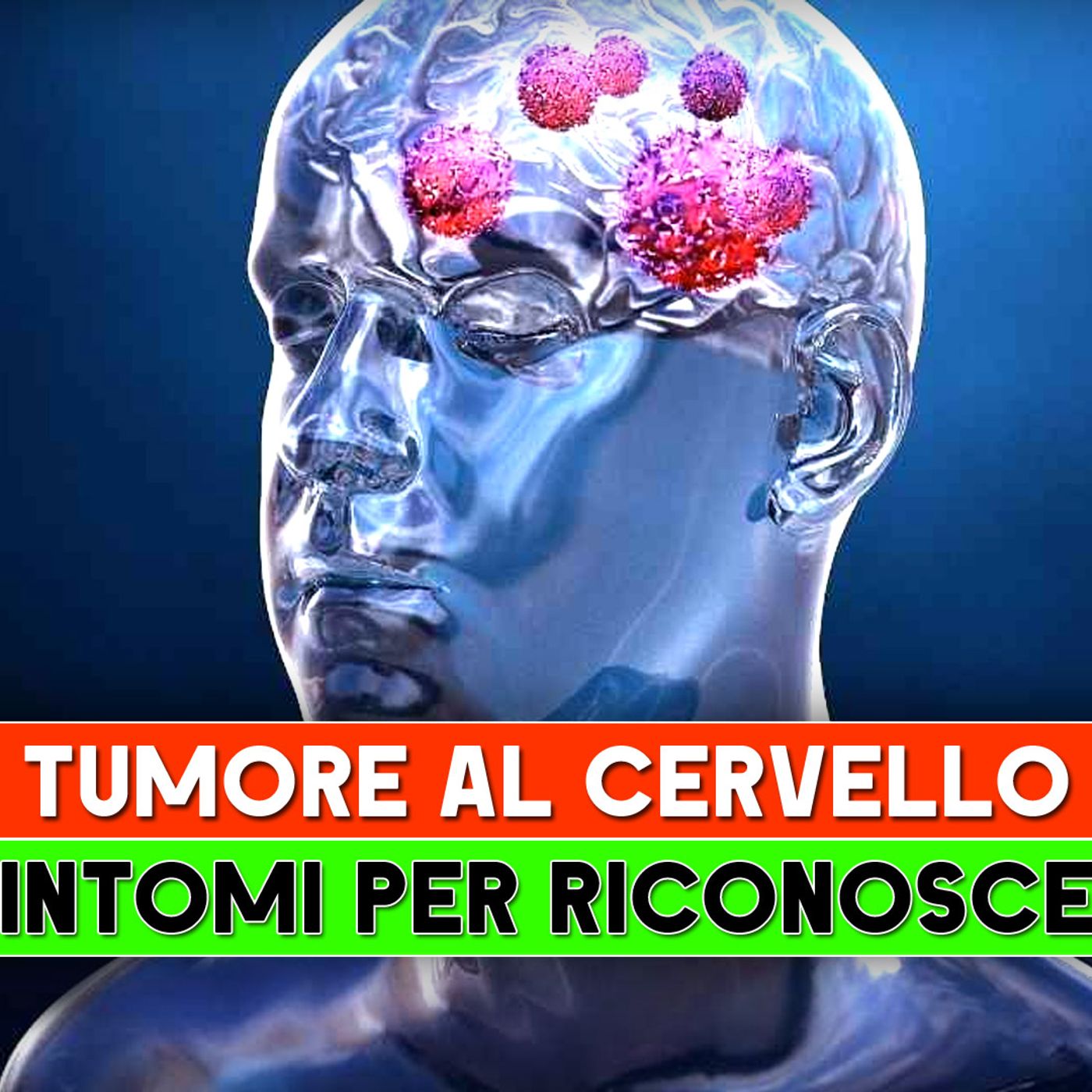 Tumore Al Cervello: I 7 Sintomi Per Riconoscerlo! episode artwork