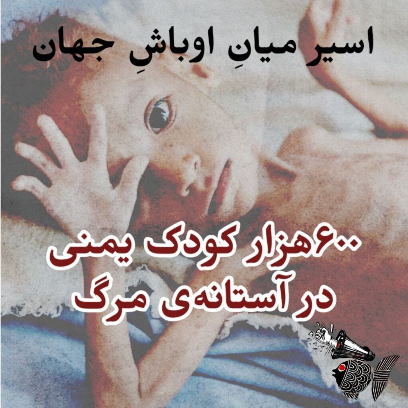 اسیر میانِ اوباش جهان | ۶۰۰ هزار کودک یمنی در آستانهٔ مرگ