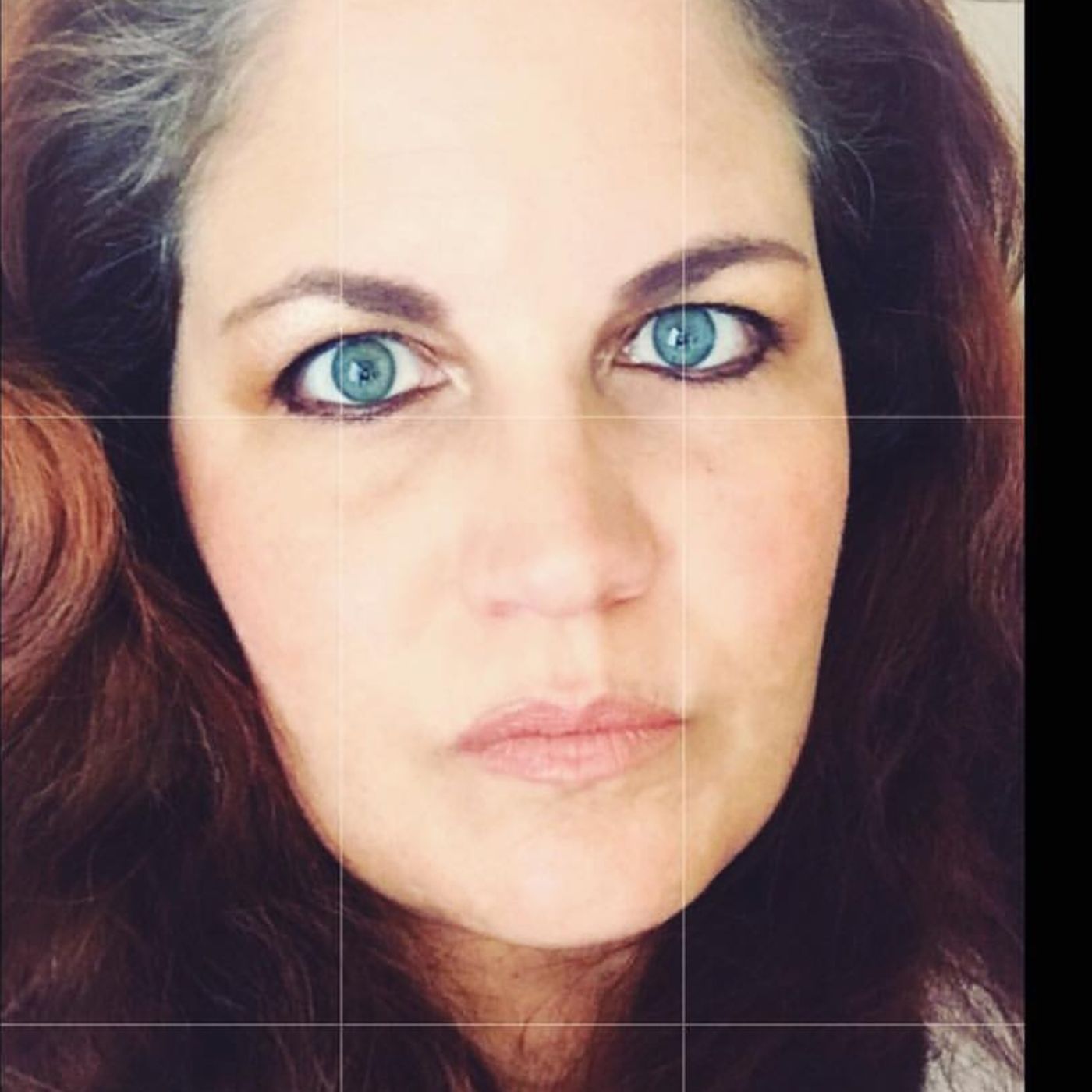 Susan Hendrix My Story Living With Lupus