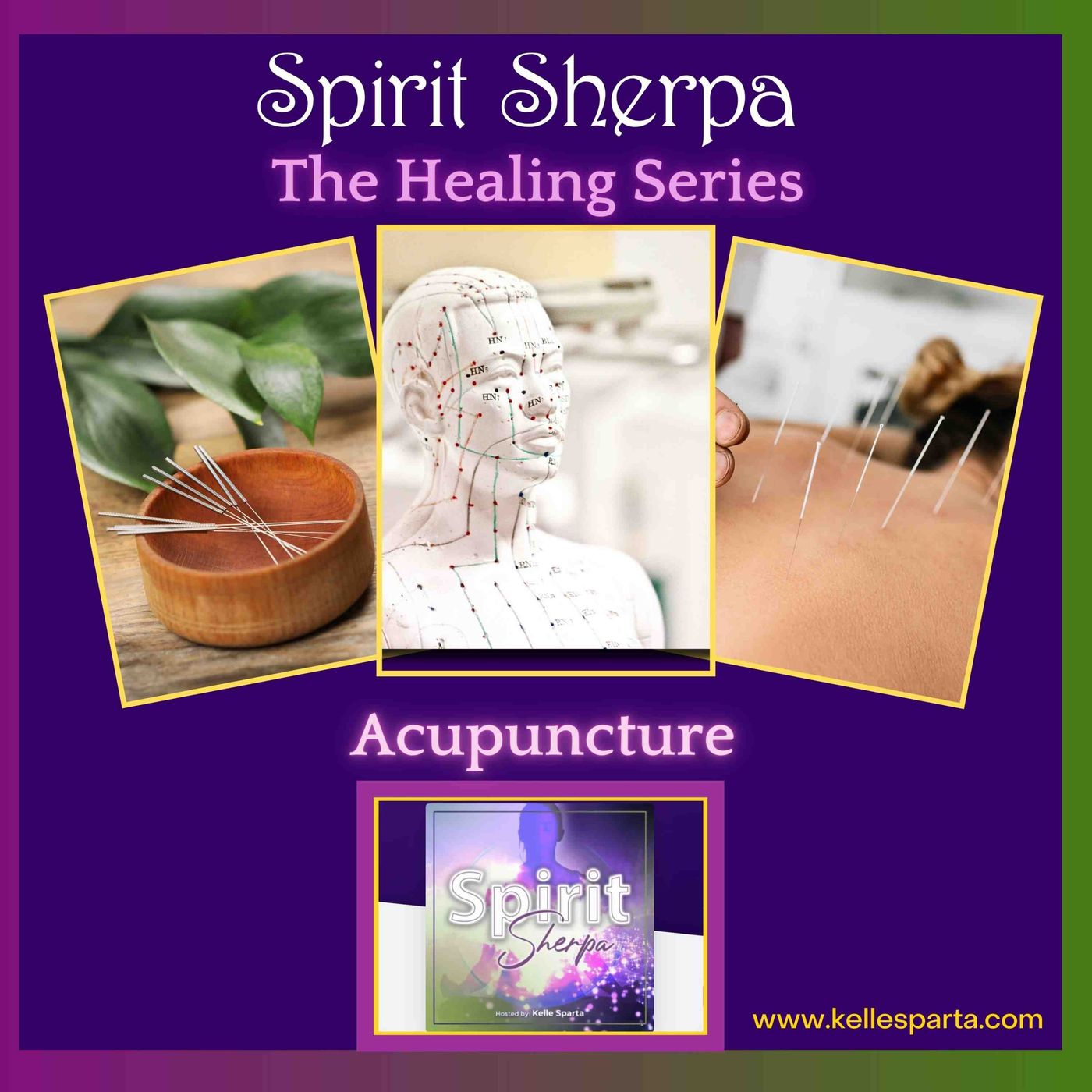 The Healing Series_  Accupuncture The Healing Series_  Accupuncture