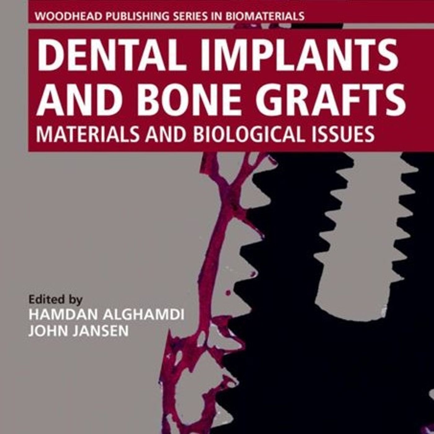 Dental Implants and Bone Grafts: Materials and Biological Issues