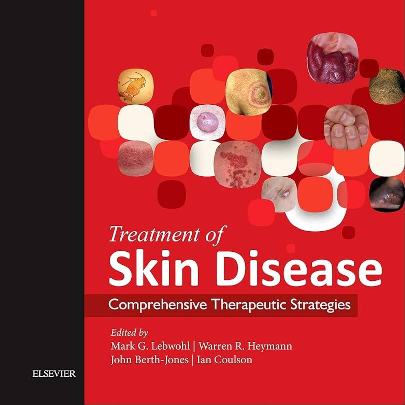 Treatment of Skin Disease: Comprehensive Therapeutic Strategies