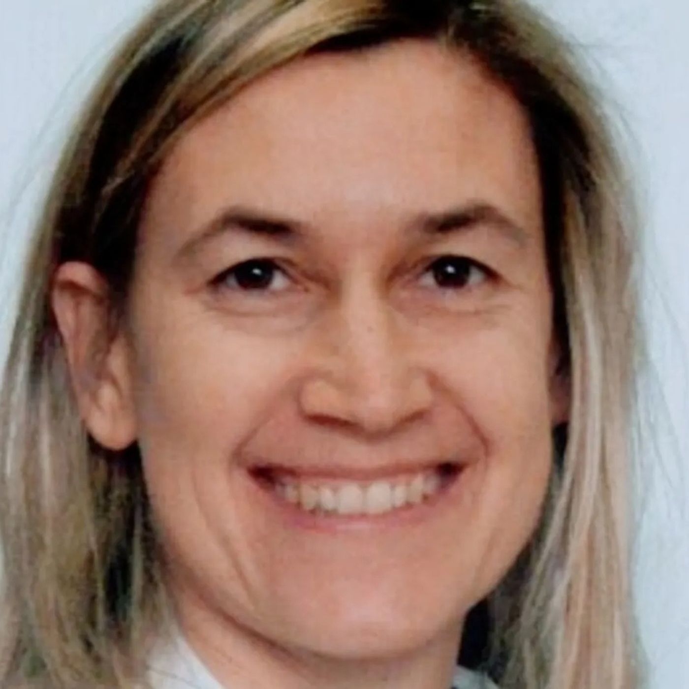 Gastroscopia: cos'è e quando farla Gastroscopia: cos'è e quando farla