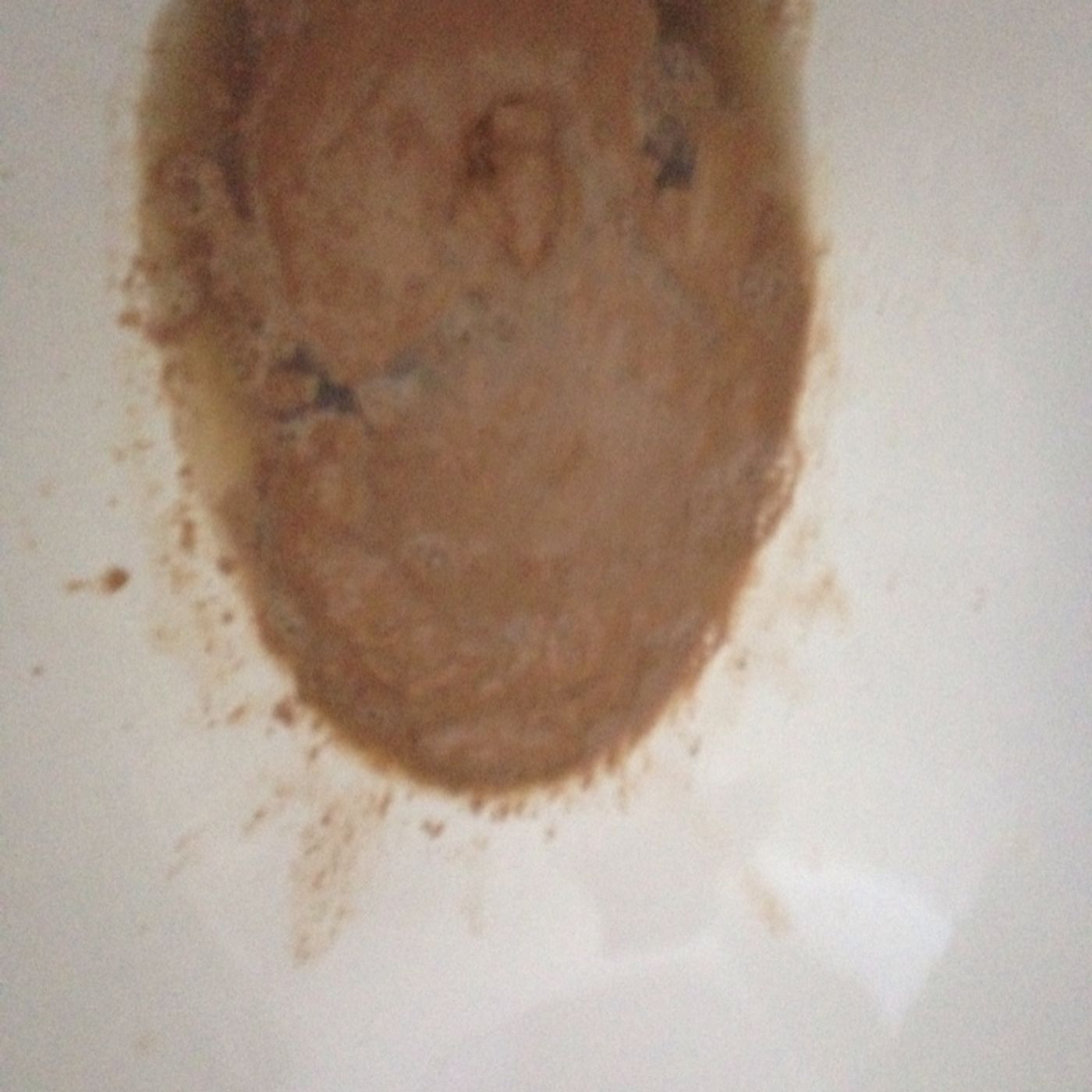 More diarrhea before episode artwork