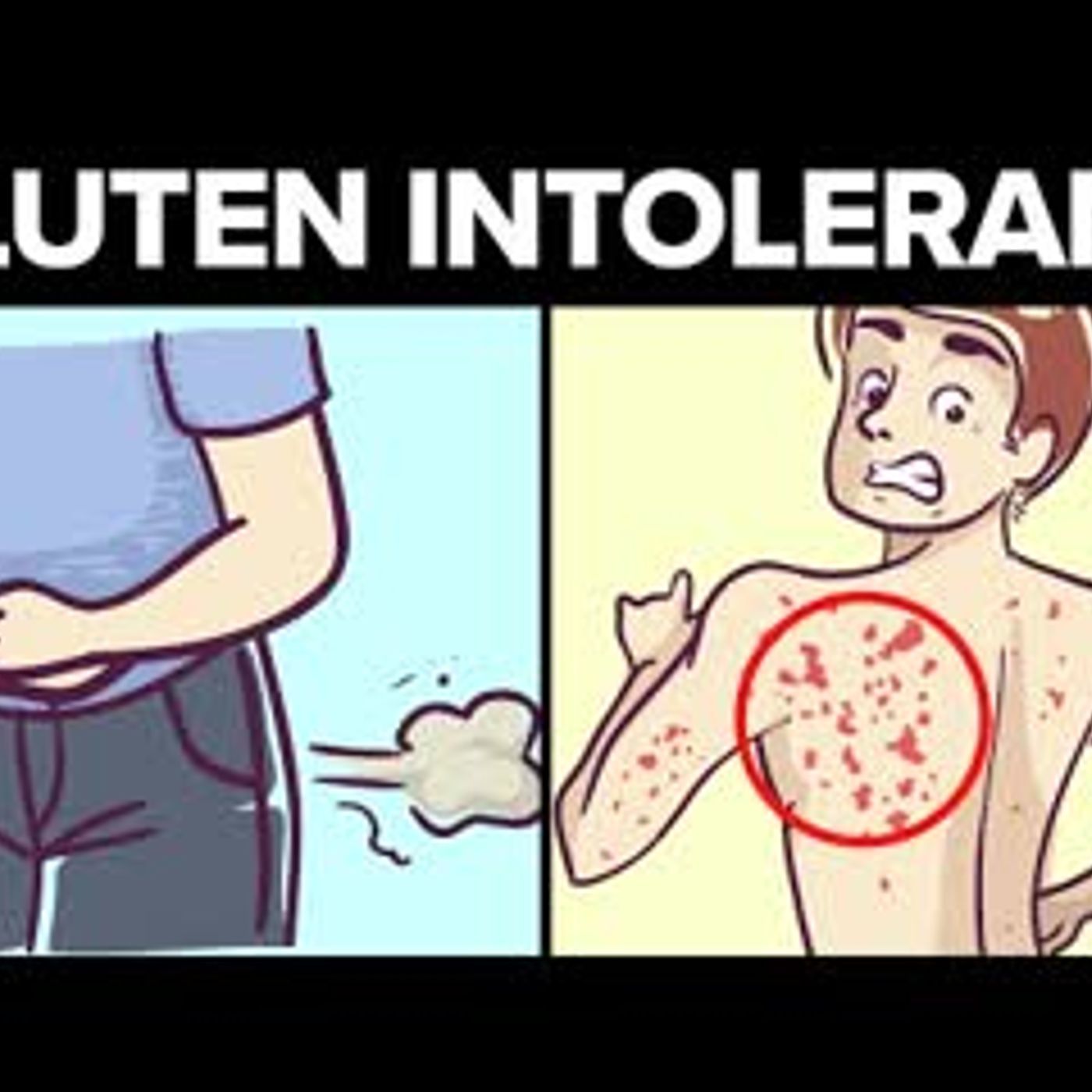 14 Surprising Signs You’re Gluten Intolerant episode artwork