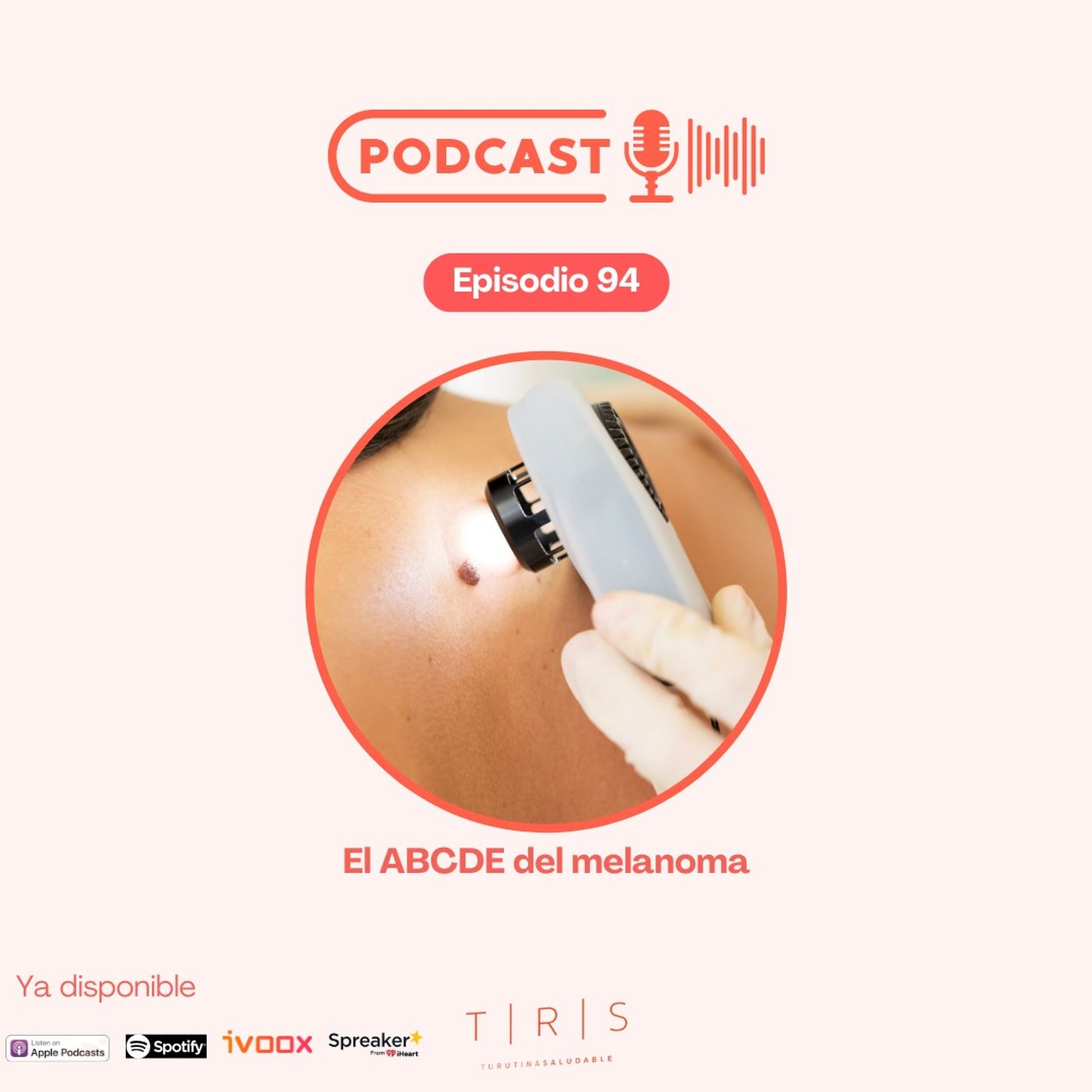 94 - El ABCDE del melanoma