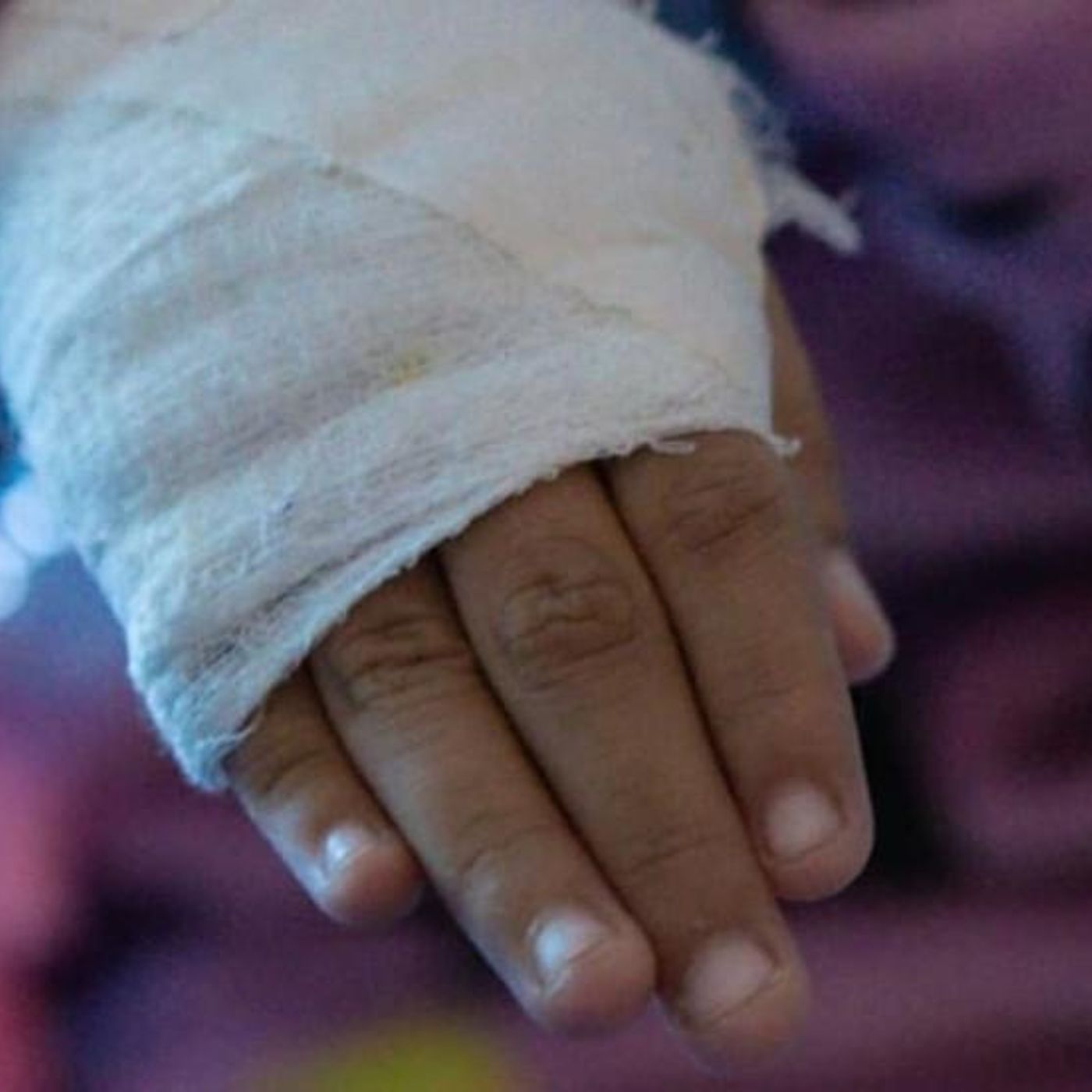 Bogotá y el drama de los quemados con pólvora: Cuatro menores de cinco años afectados en la noche de velitas