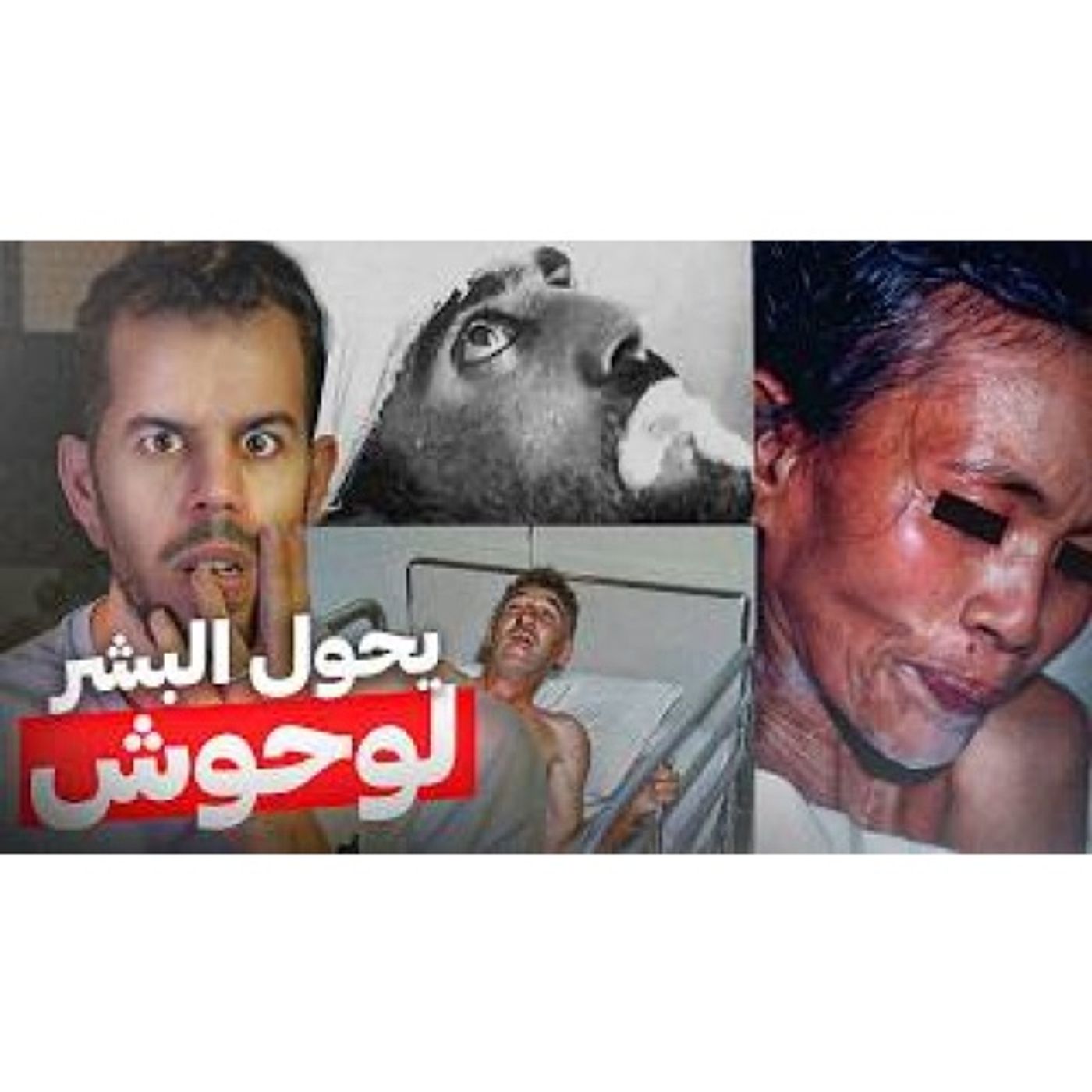 فيــروس الرعب الأسود episode artwork