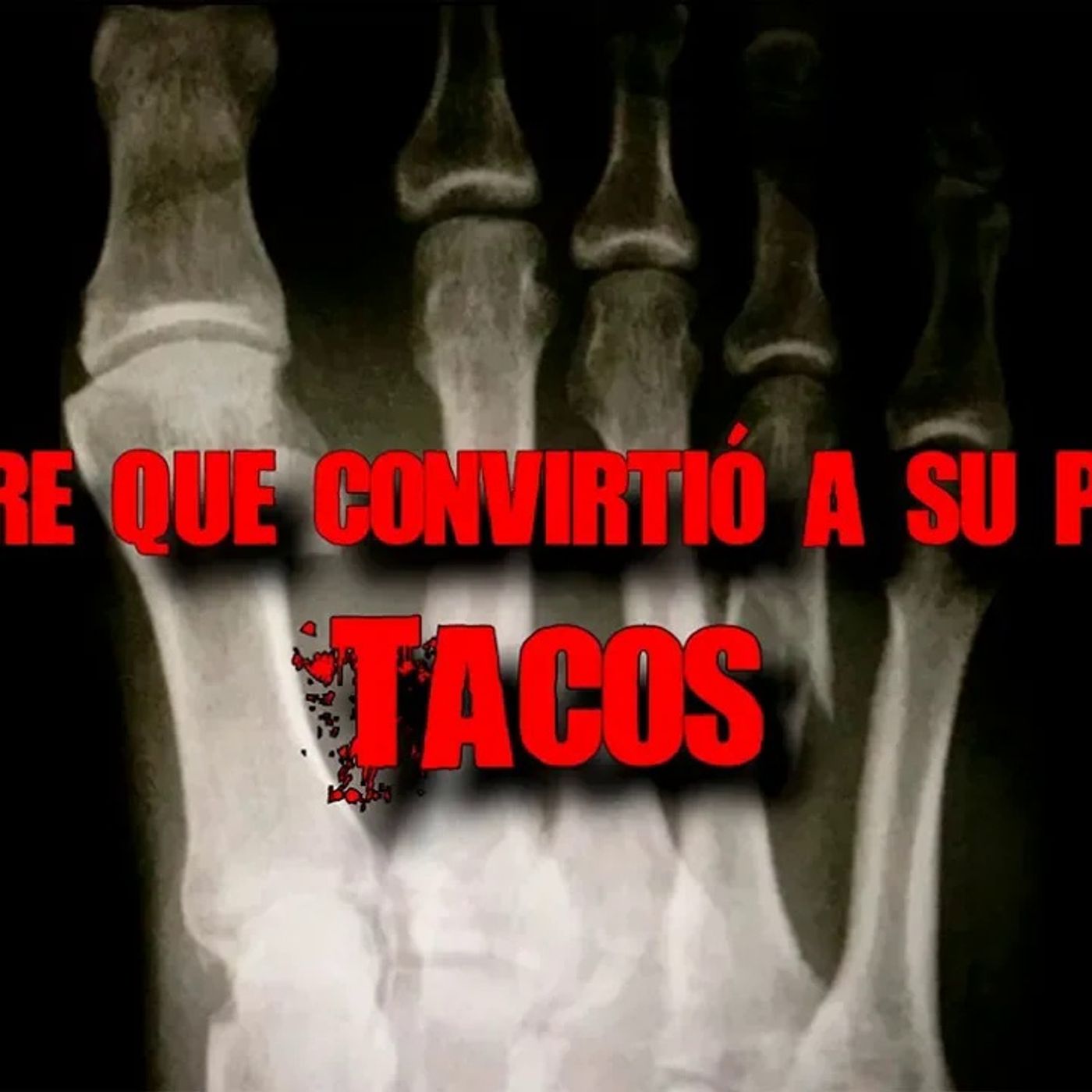 Portada de El Podcast de DrossRotzank
