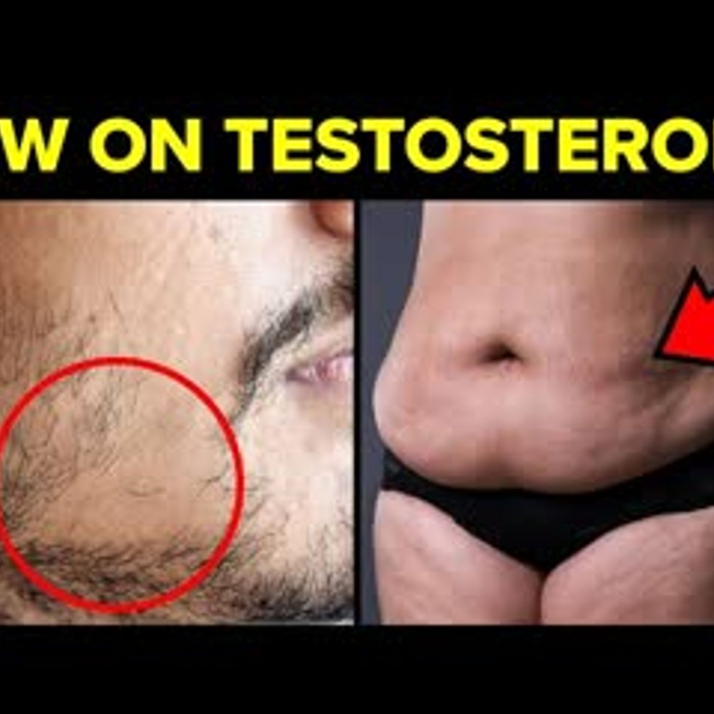 10 Reasons Why Your Testosterone Is Low & How To Increase It episode artwork