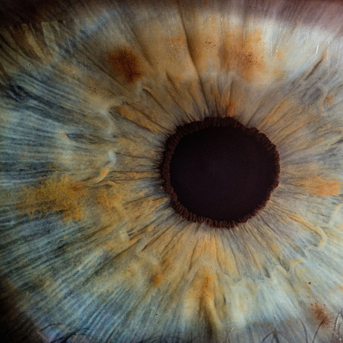 Lenti a contatto contro la depressione i ricercatori coreani usano la retina per stimolare il cervello episode artwork