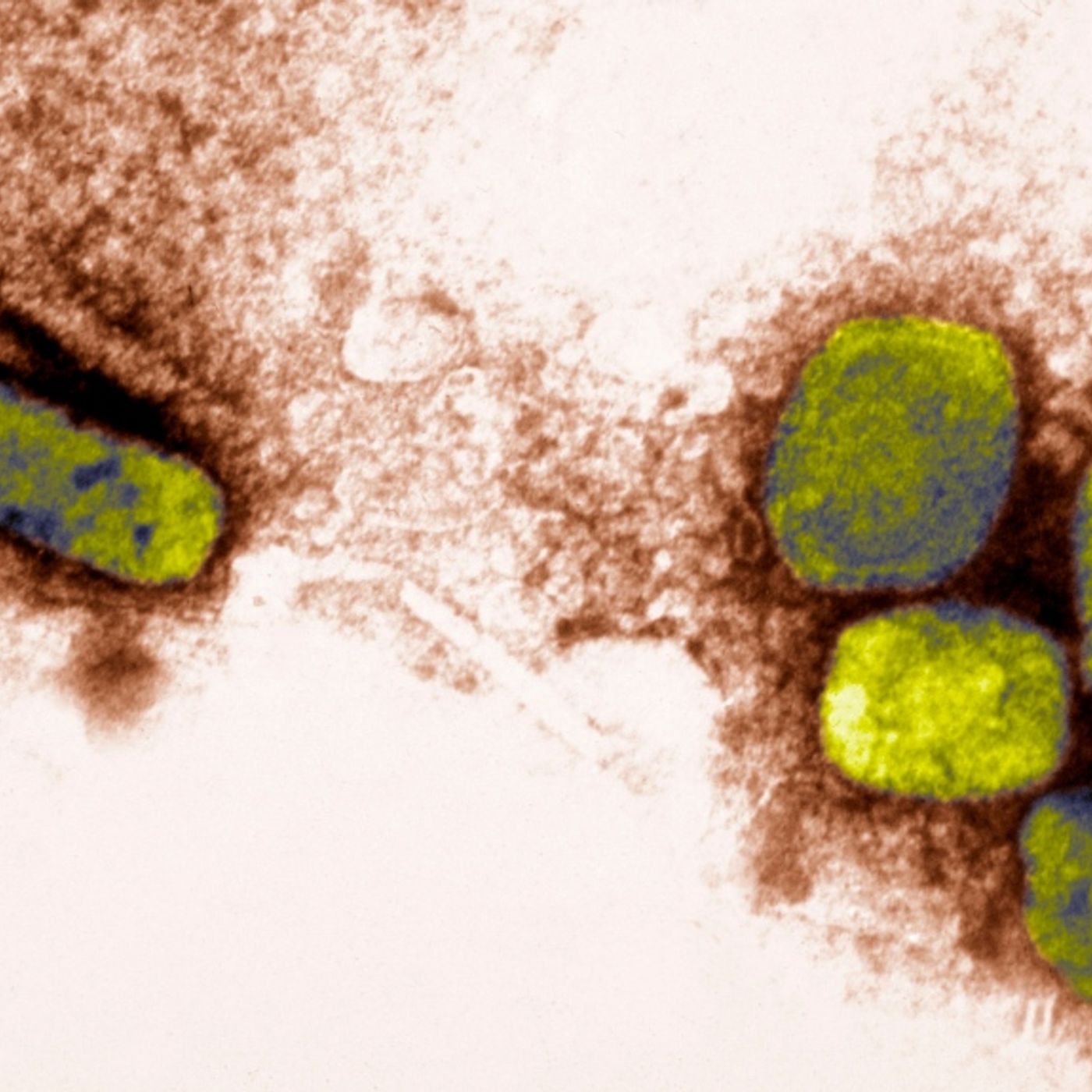 Smallpox Conspiracy Podcasts | Incoming Release or False Flag