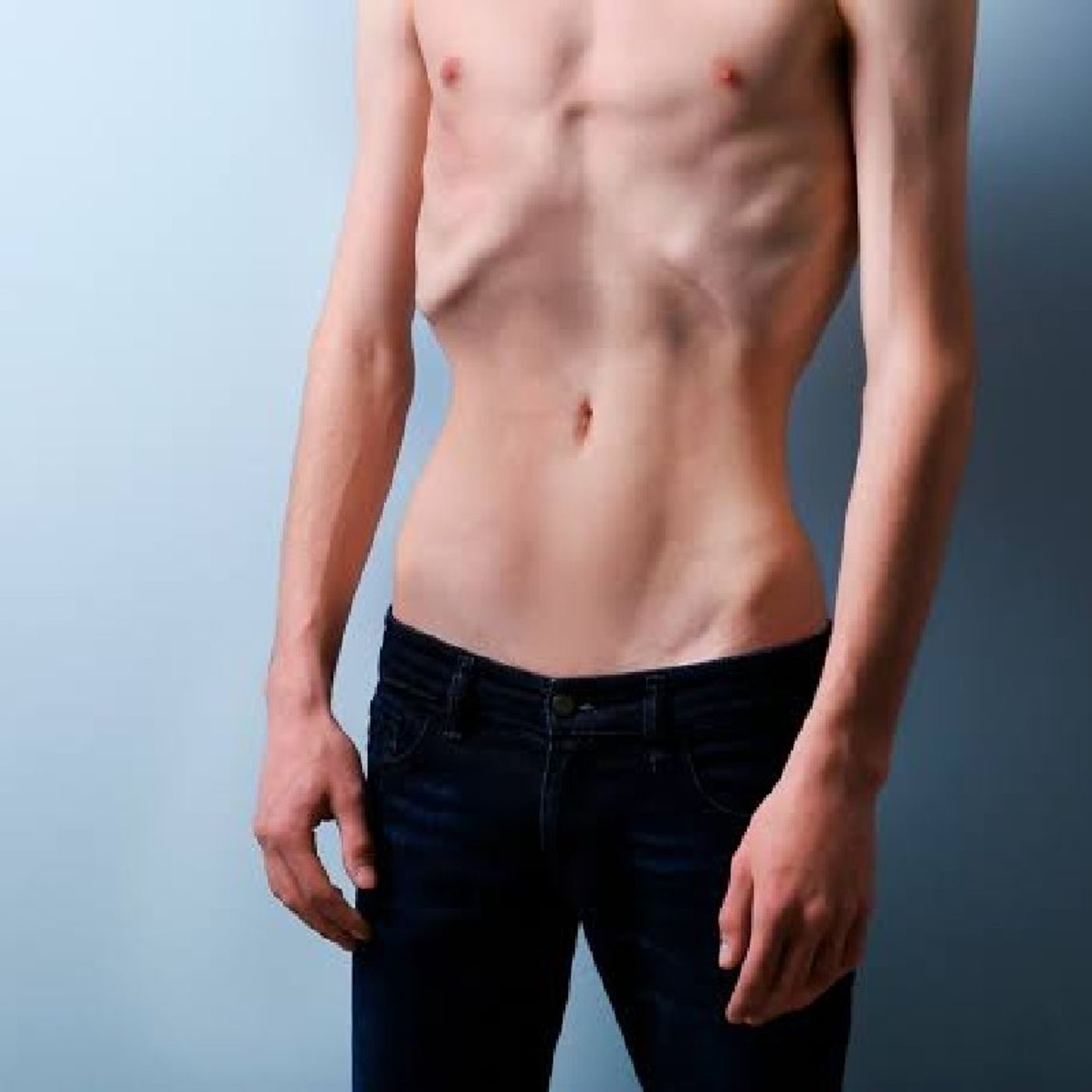 Anorexia y bulimia parte 2 episode artwork
