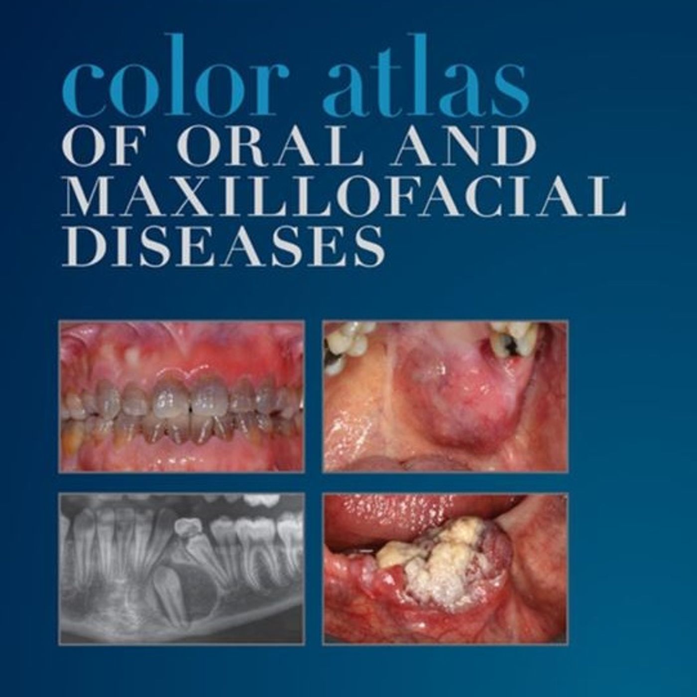 Color Atlas of Oral and Maxillofacial Diseases