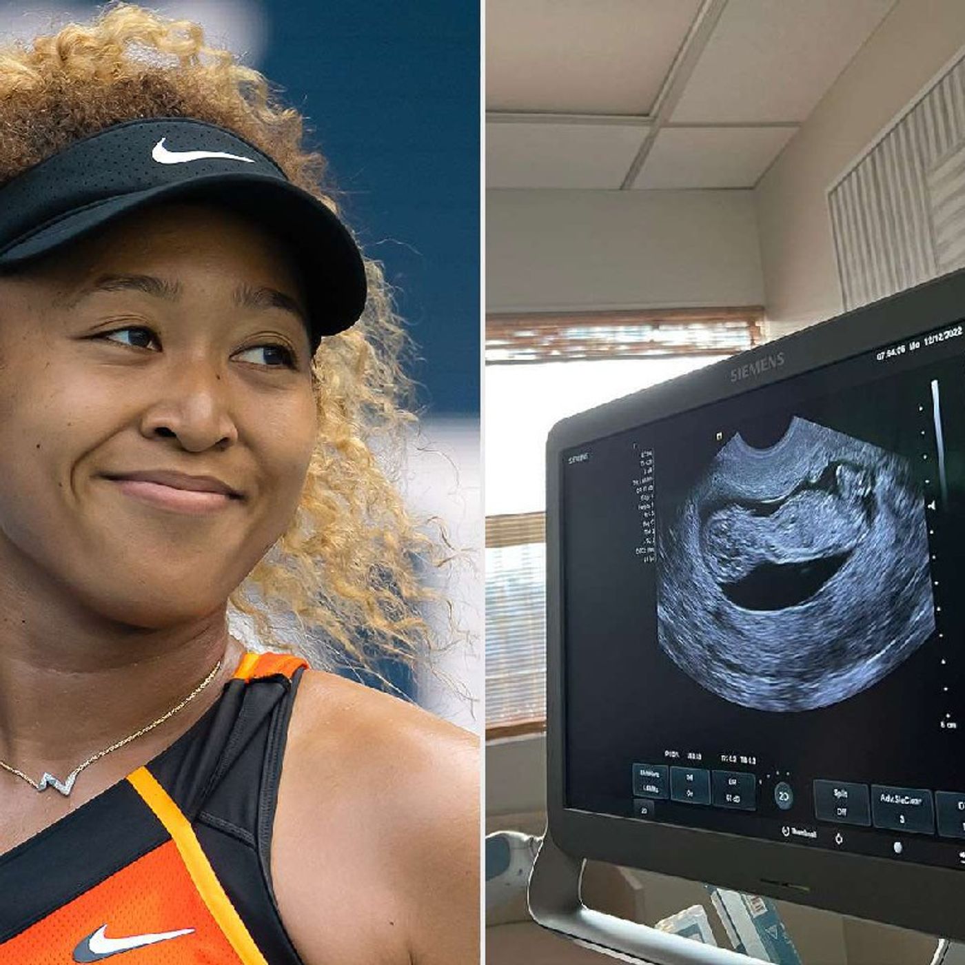 Naomi Osaka Is Pregnant episode artwork