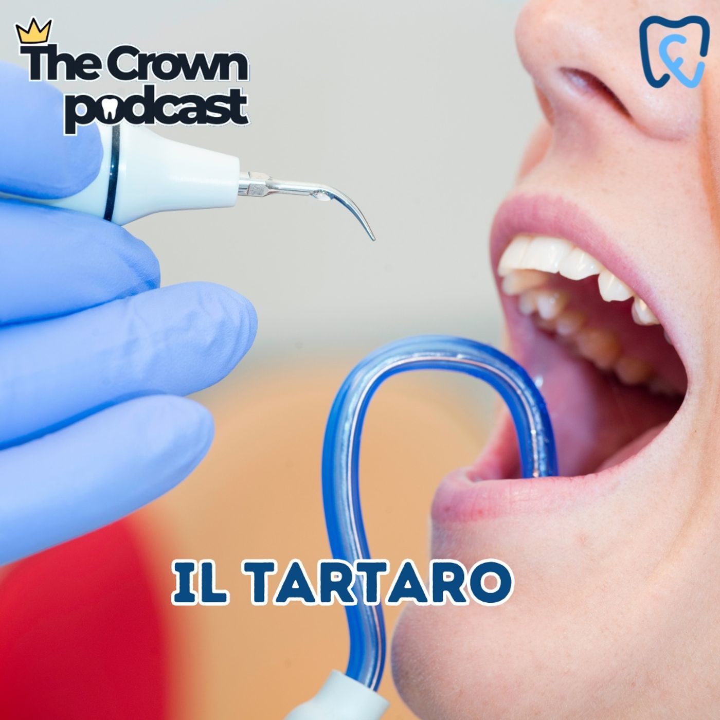 The Crown - Un podcast dentale