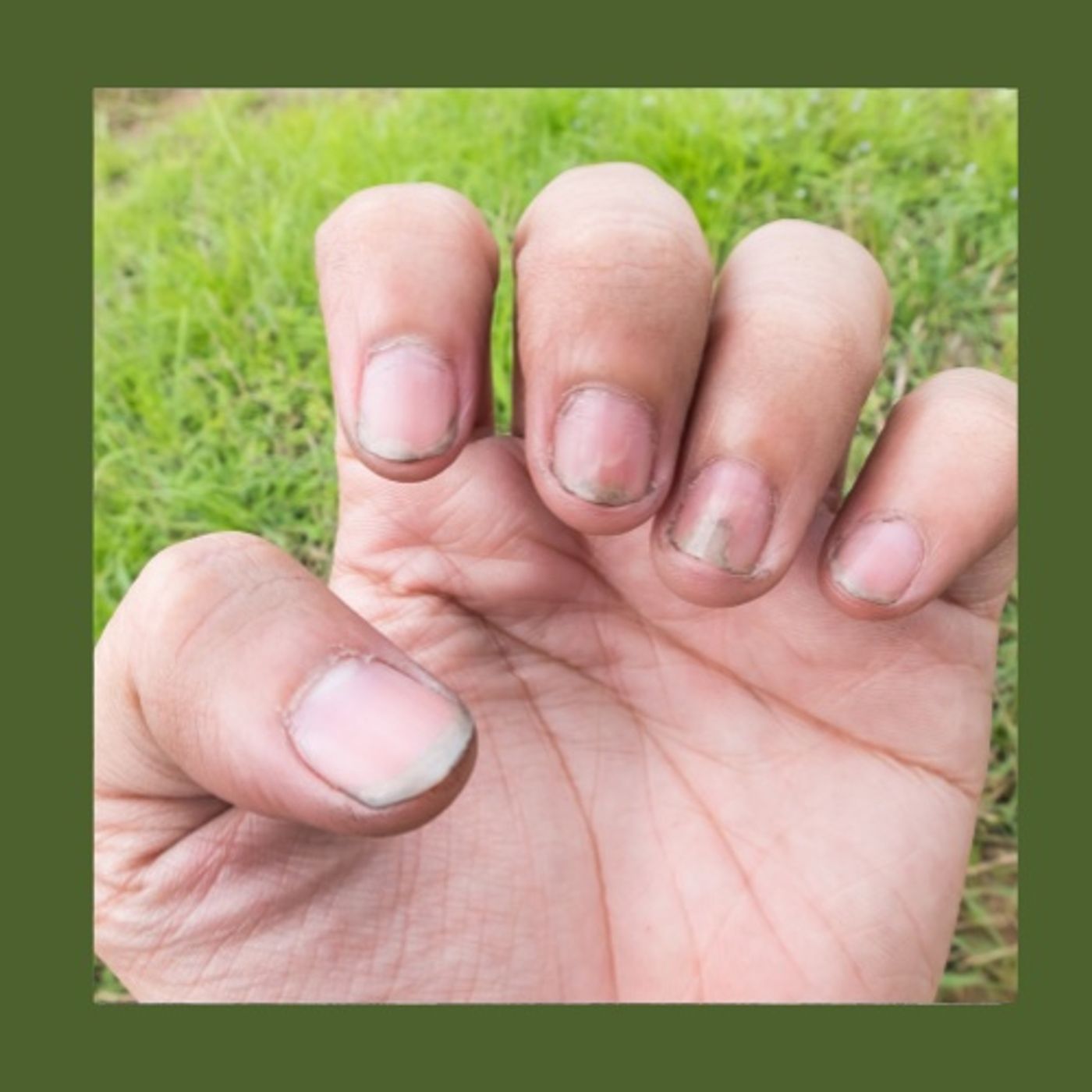 #214 Il giardino non si controlla: si ascolta