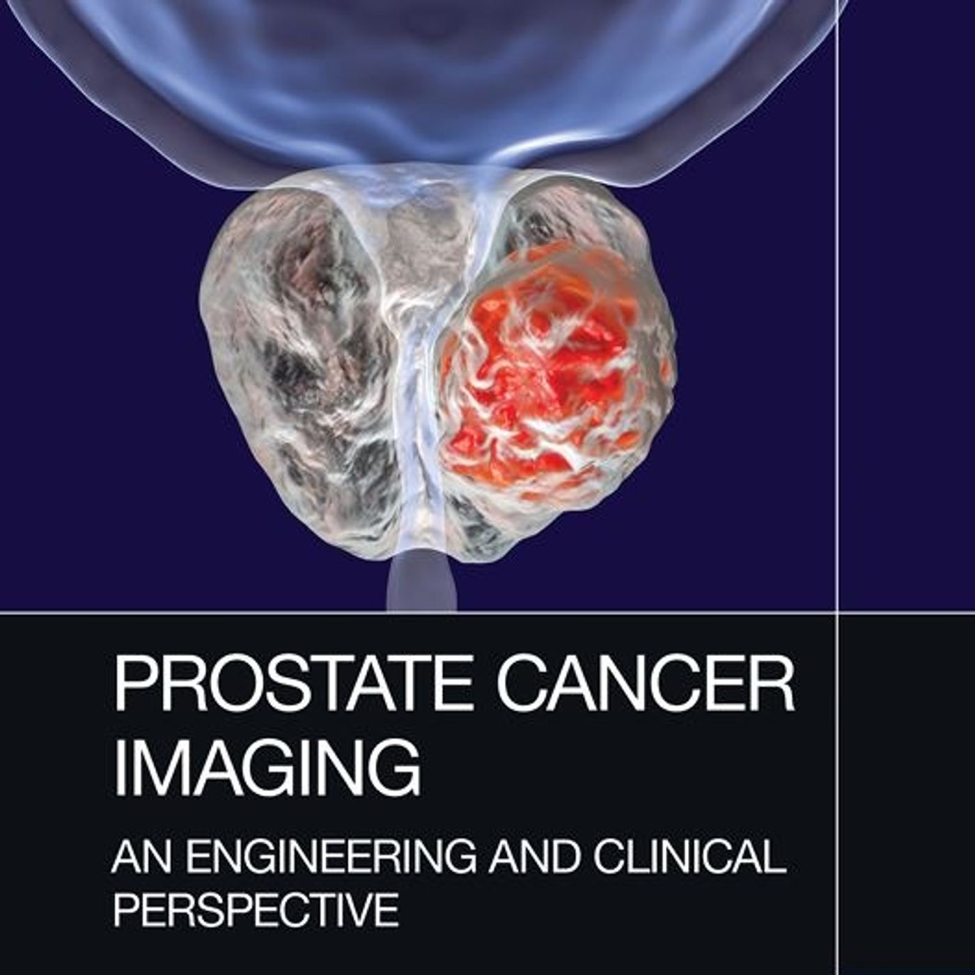 Prostate Cancer Imaging: An Engineering and Clinical Perspectives episode artwork