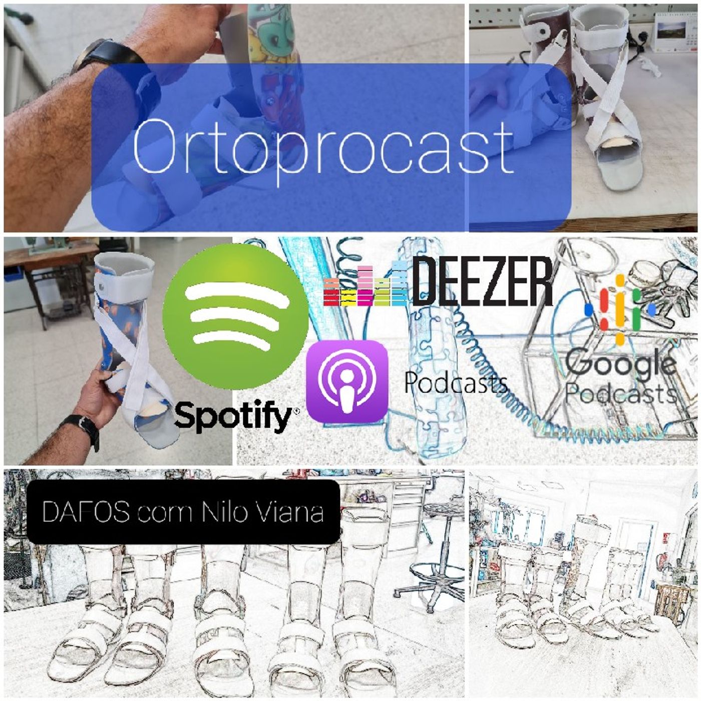 Ortoprocast