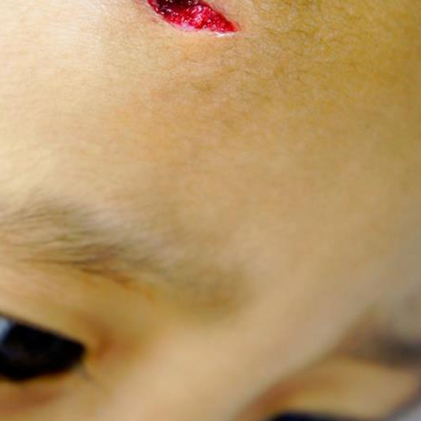 Survival Medicine Hour: Acid Reflux, Medical Barter Items, Colds vs Flus, More