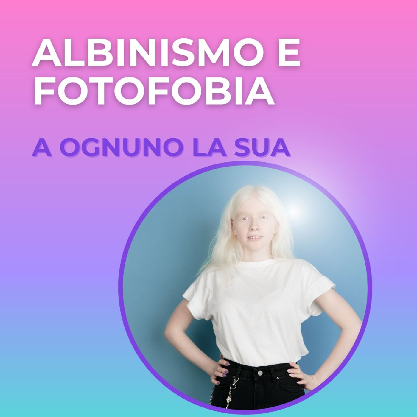 Nero su bianco  - storie di albinismo