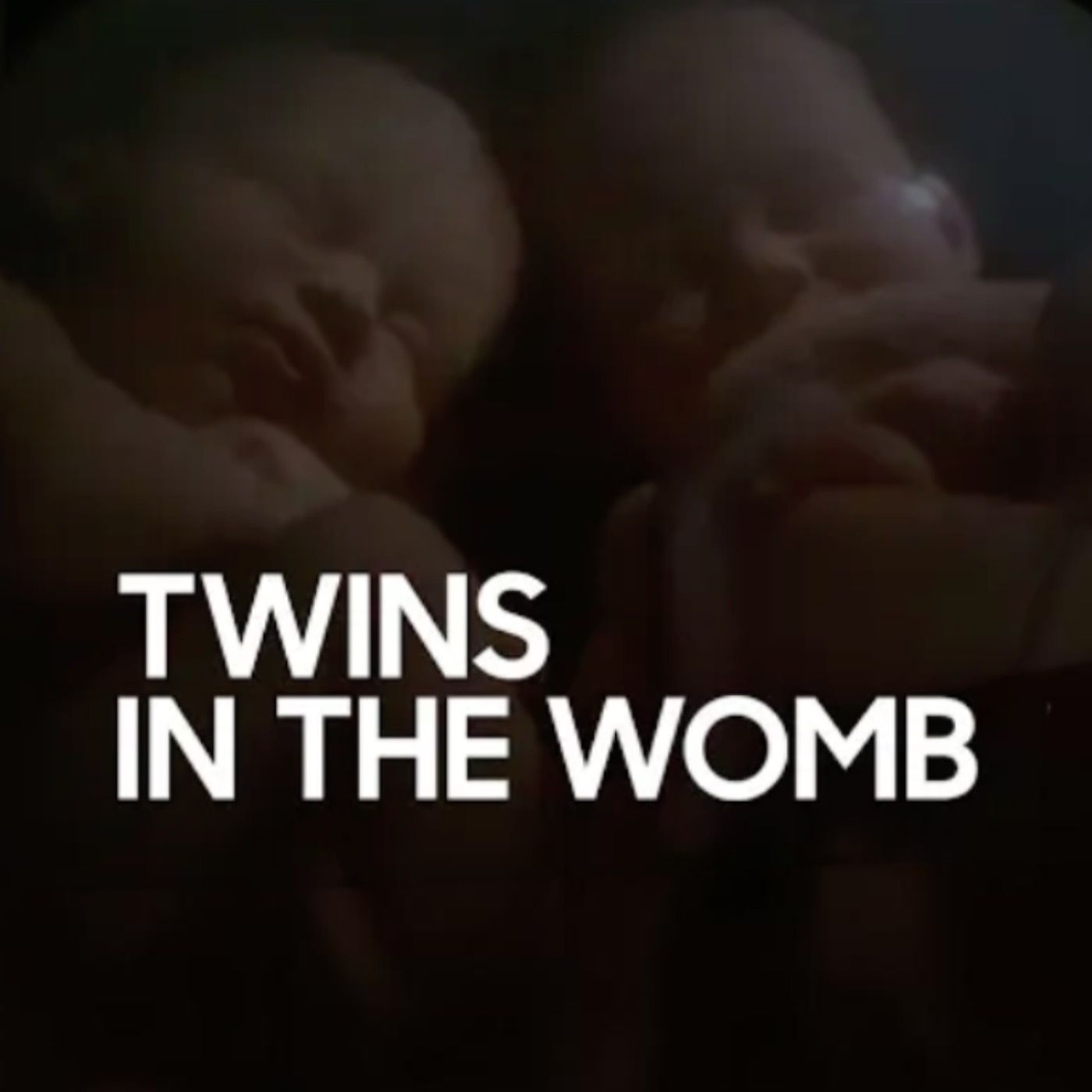 Twins in the Womb | Mufti Menk Podcast