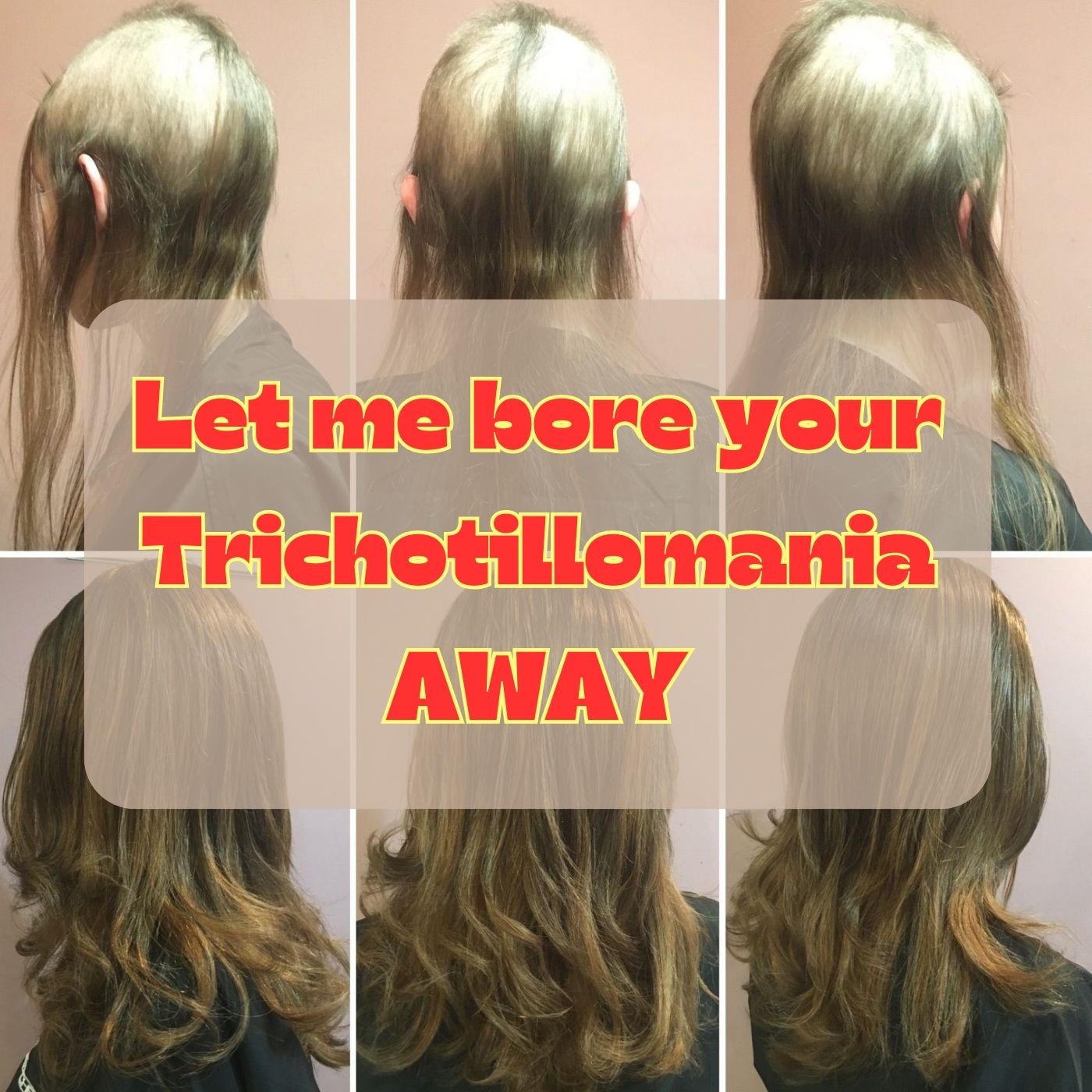 (Kara) Let me bore your  Trichotillomania (hair pulling) AWAY episode artwork