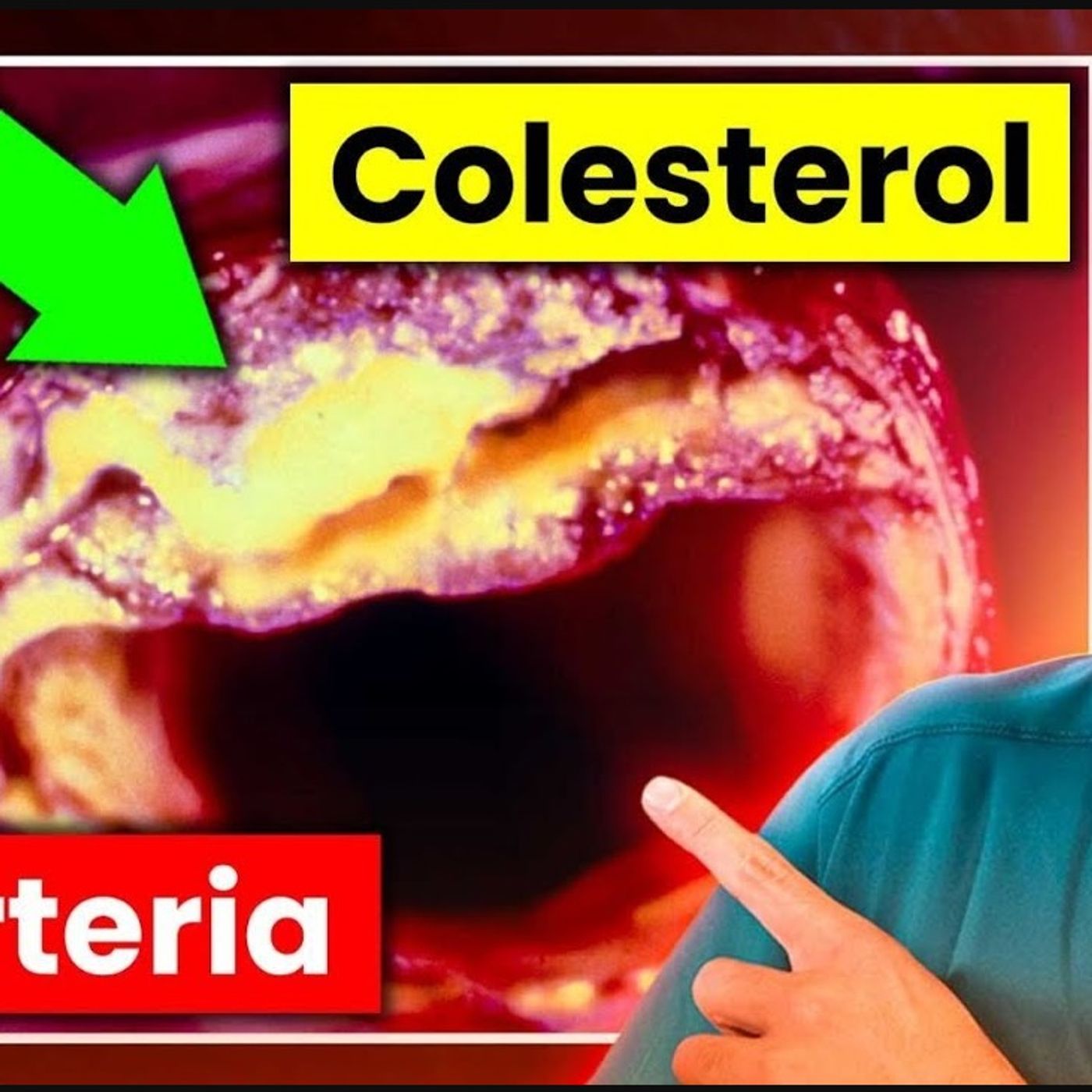 ¡ALERTA COLESTEROL!⚠️Cómo OPTIMIZAR sus NIVELES sin MODIFICAR tu DIETA