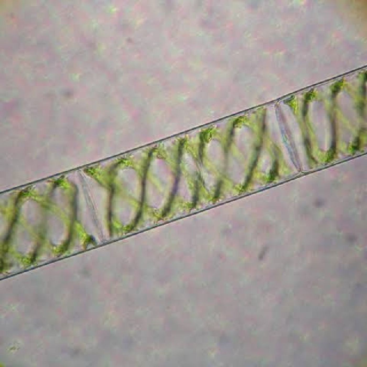 Spirogyra : Que Plâncton é Esse?