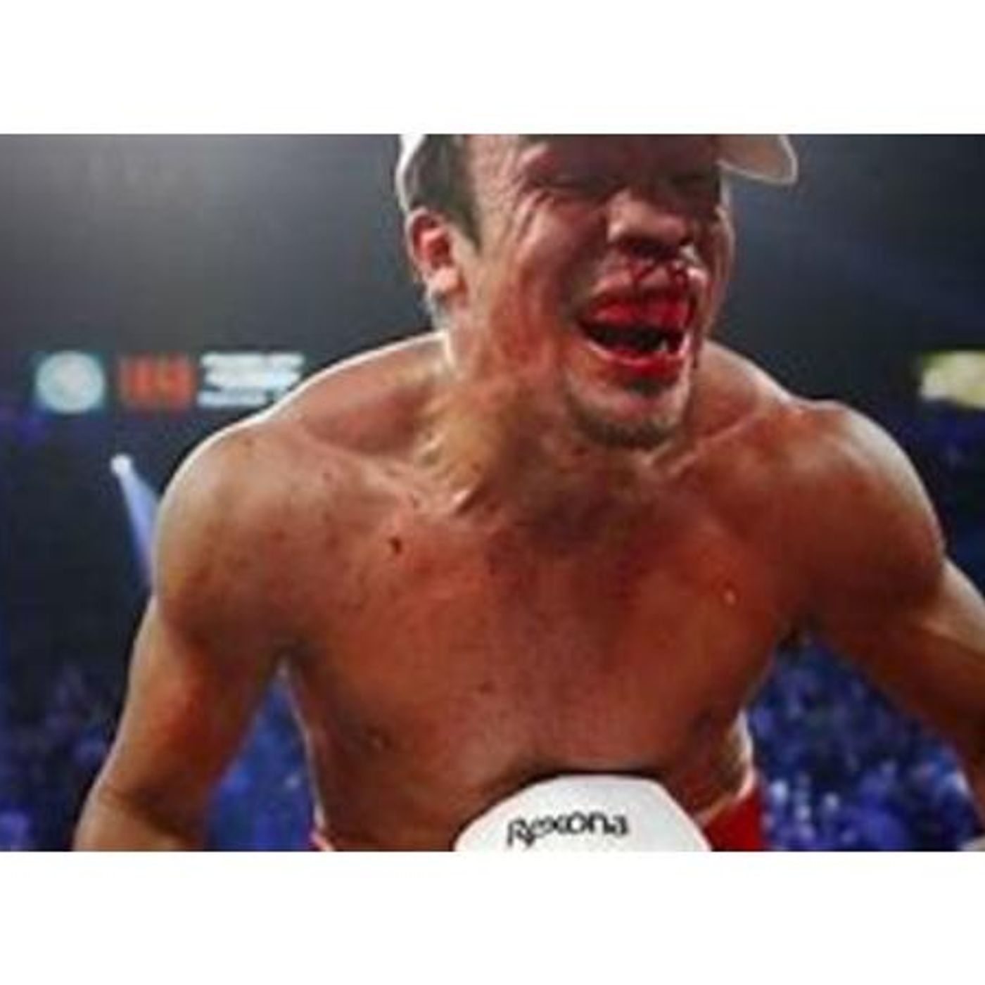 The Best Division in Boxing is 147, 154, 135, 118? Mike Tyson Comeback WTF??!! episode artwork