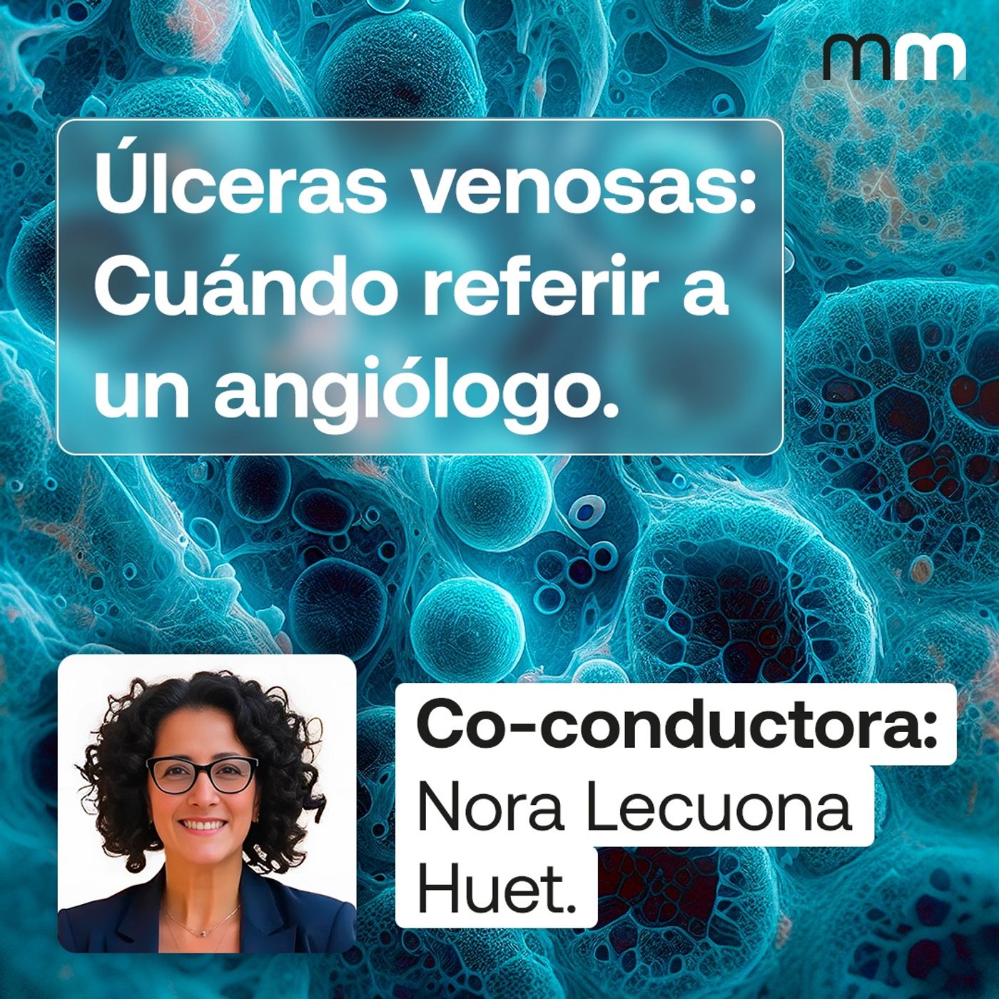 ¿Cuándo debe referir un paciente con úlceras venosas a un angiólogo?