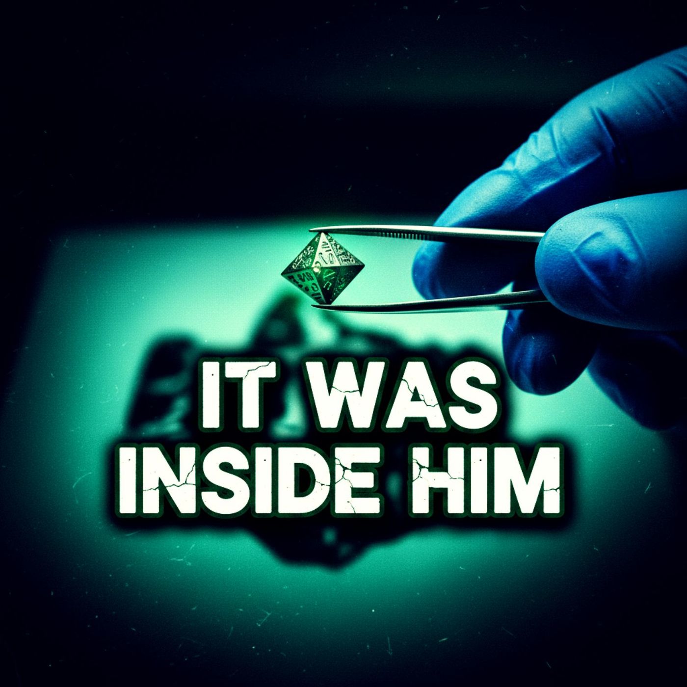 "Surgically Removed": Alien Implants & The Elite Team Hunting UFOs (Real Life X-Files) "Surgically Removed": Alien Implants & The Elite Team Hunting UFOs (Real Life X-Files)