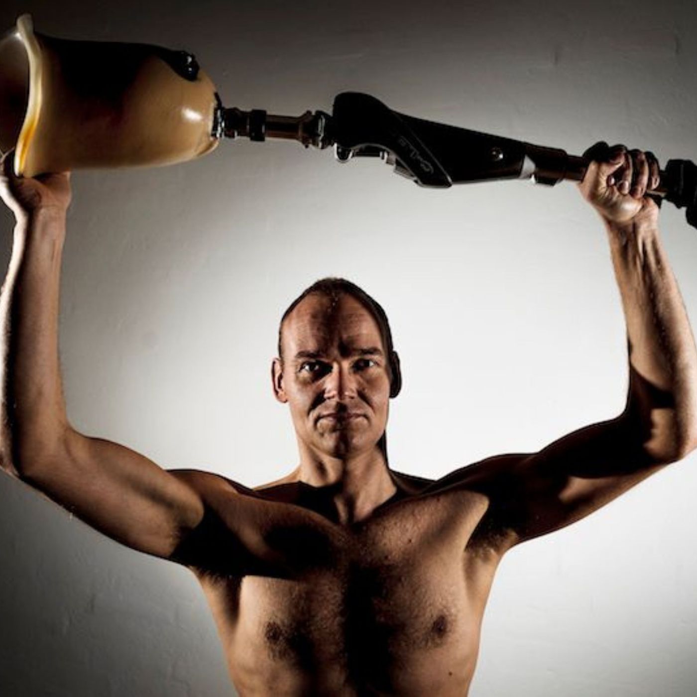 Gert Rune blev ramt af knoglekræft som 16-årig: "Så kører de mig på operationsbordet og skærer mit ben af"