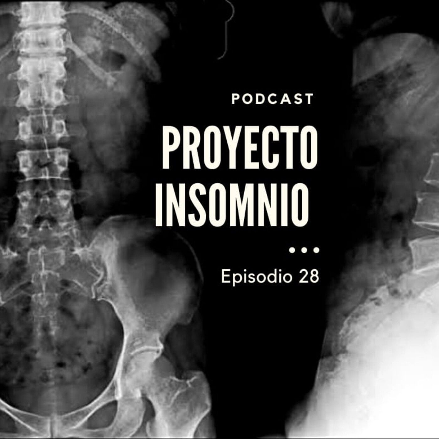 Proyecto Insomnio
