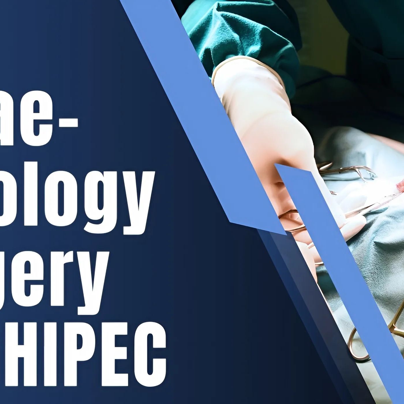Is Oncoplasty the Right Choice for You_ Learn the Pros and Cons episode artwork