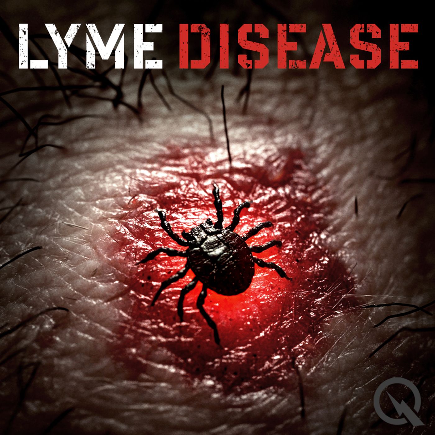 Lyme Disease