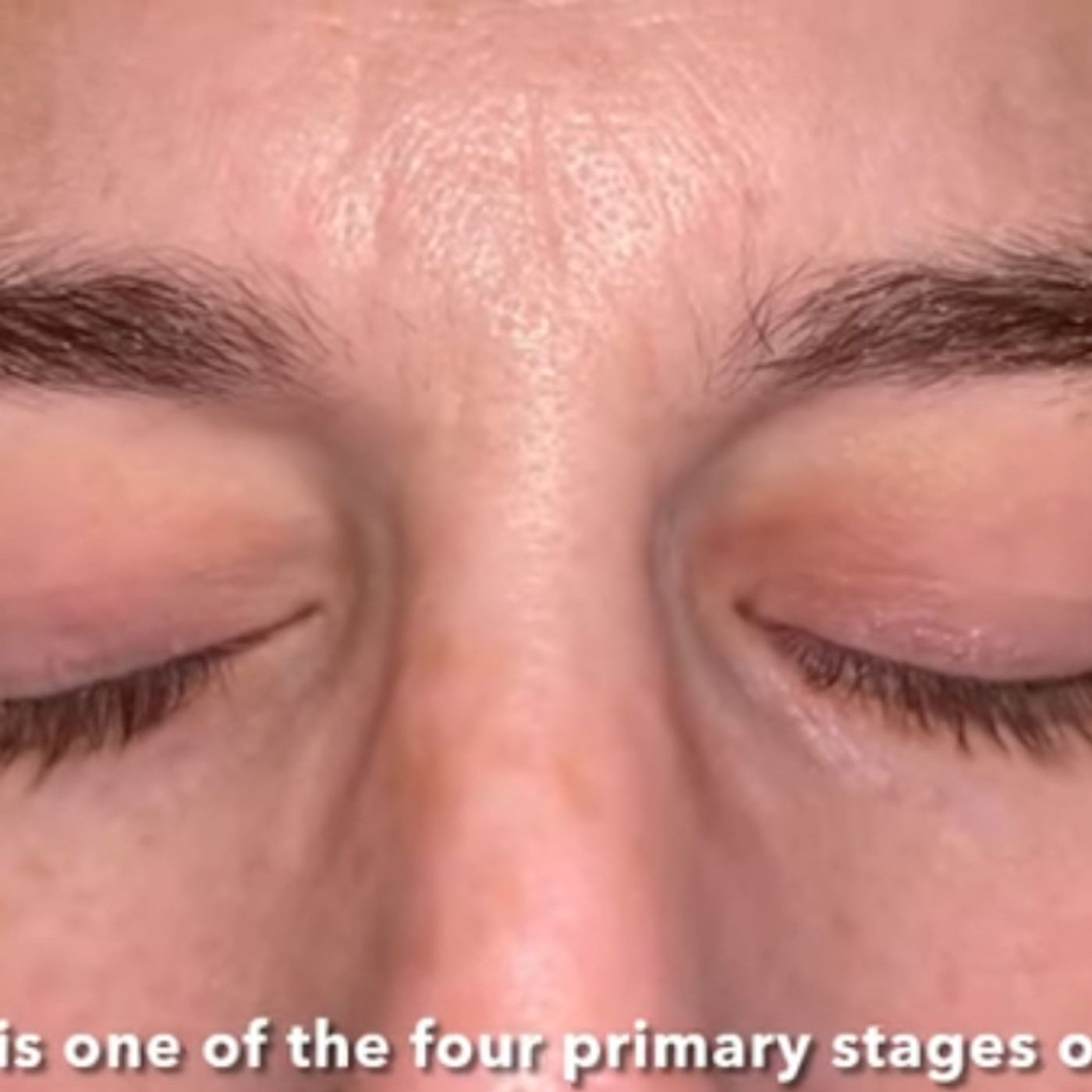 S57E13: What Is The Rapid Eye Movement (REM) And Why Is It Present In Our Sleep