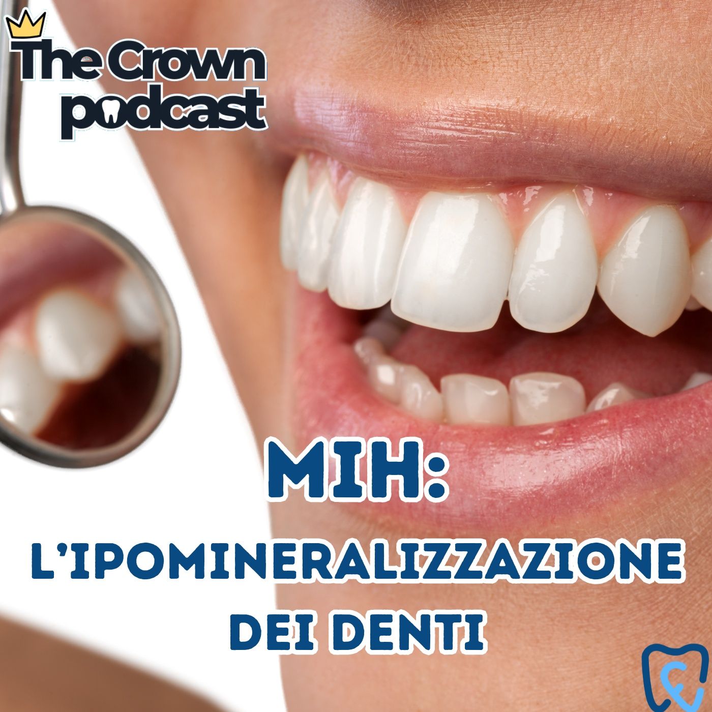 The Crown - Un podcast dentale