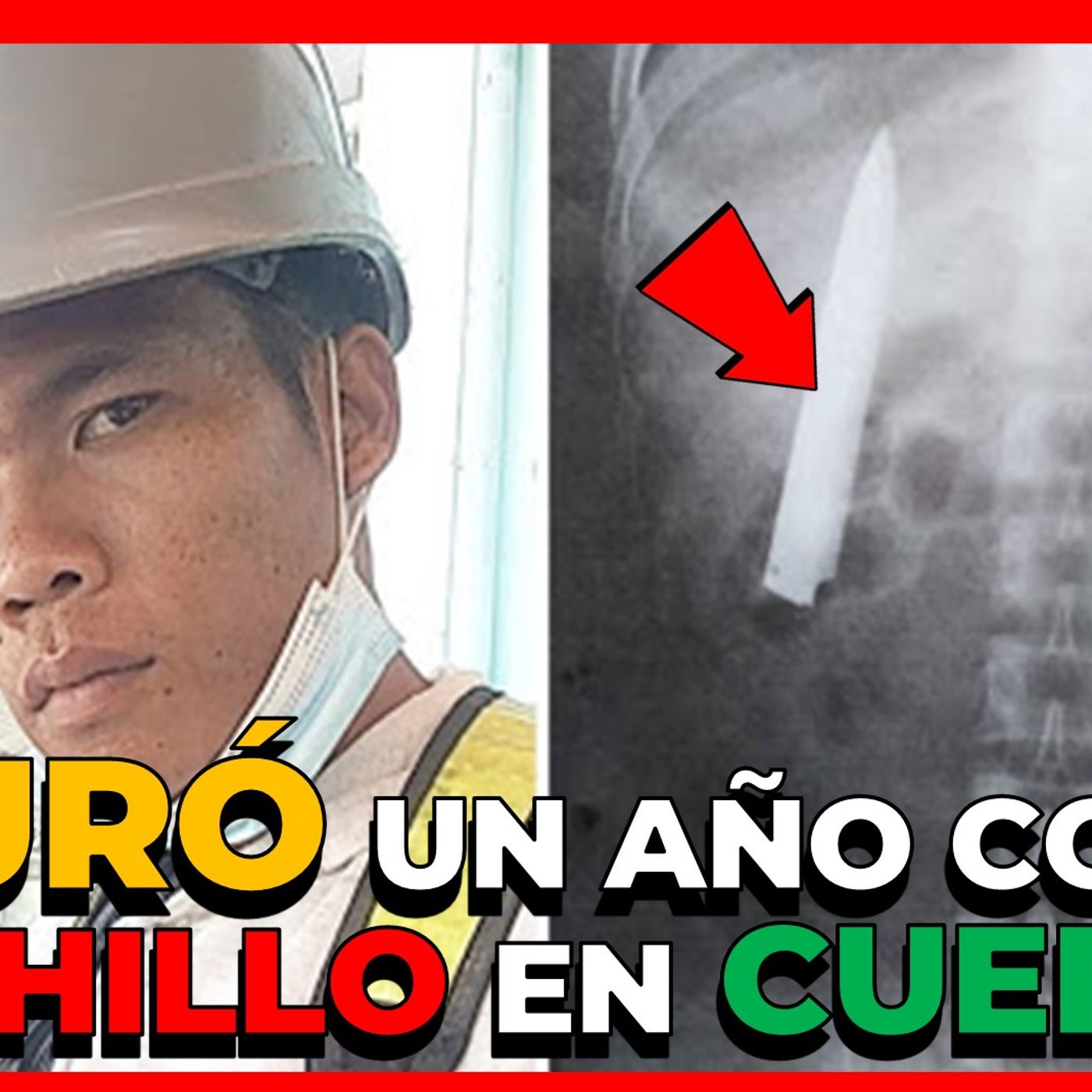 INSÓLITO FILIPINO VIVIÓ DURANTE 1 AÑO CON UN CUCHILLO EN SU CUERPO SIN SABERLO episode artwork